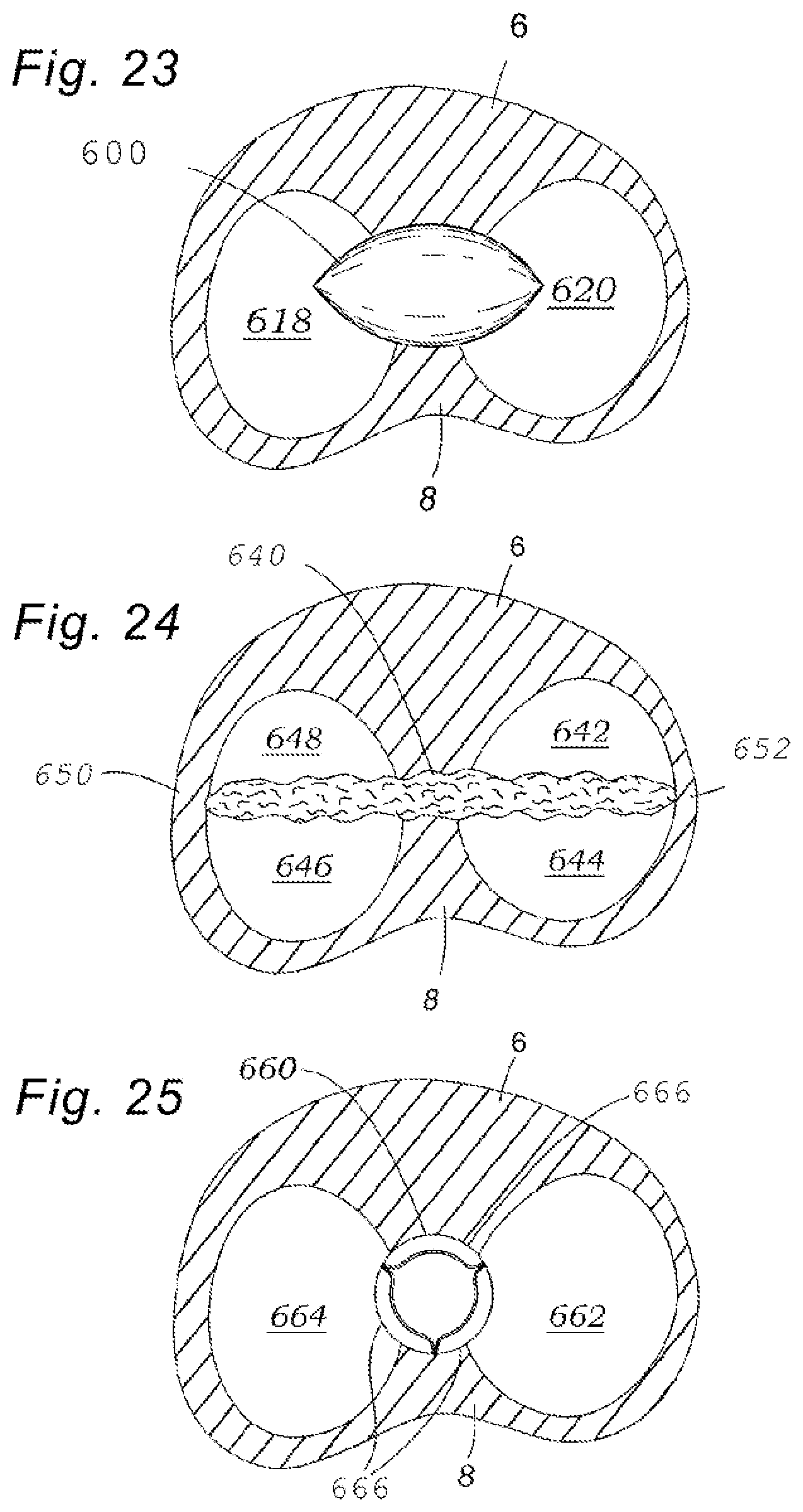Patent US12318294 Figure 10 – Tissue grasping devices and related methods