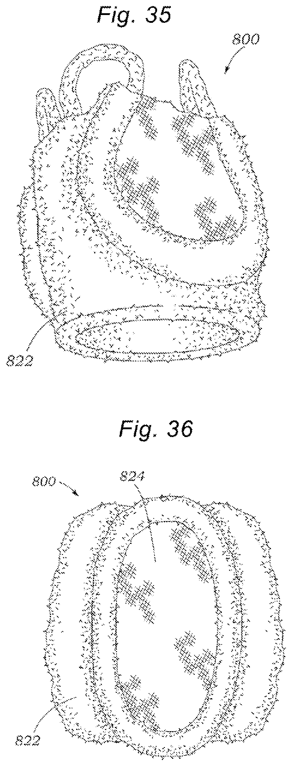 Patent US12318294 Figure 14 – Tissue grasping devices and related methods