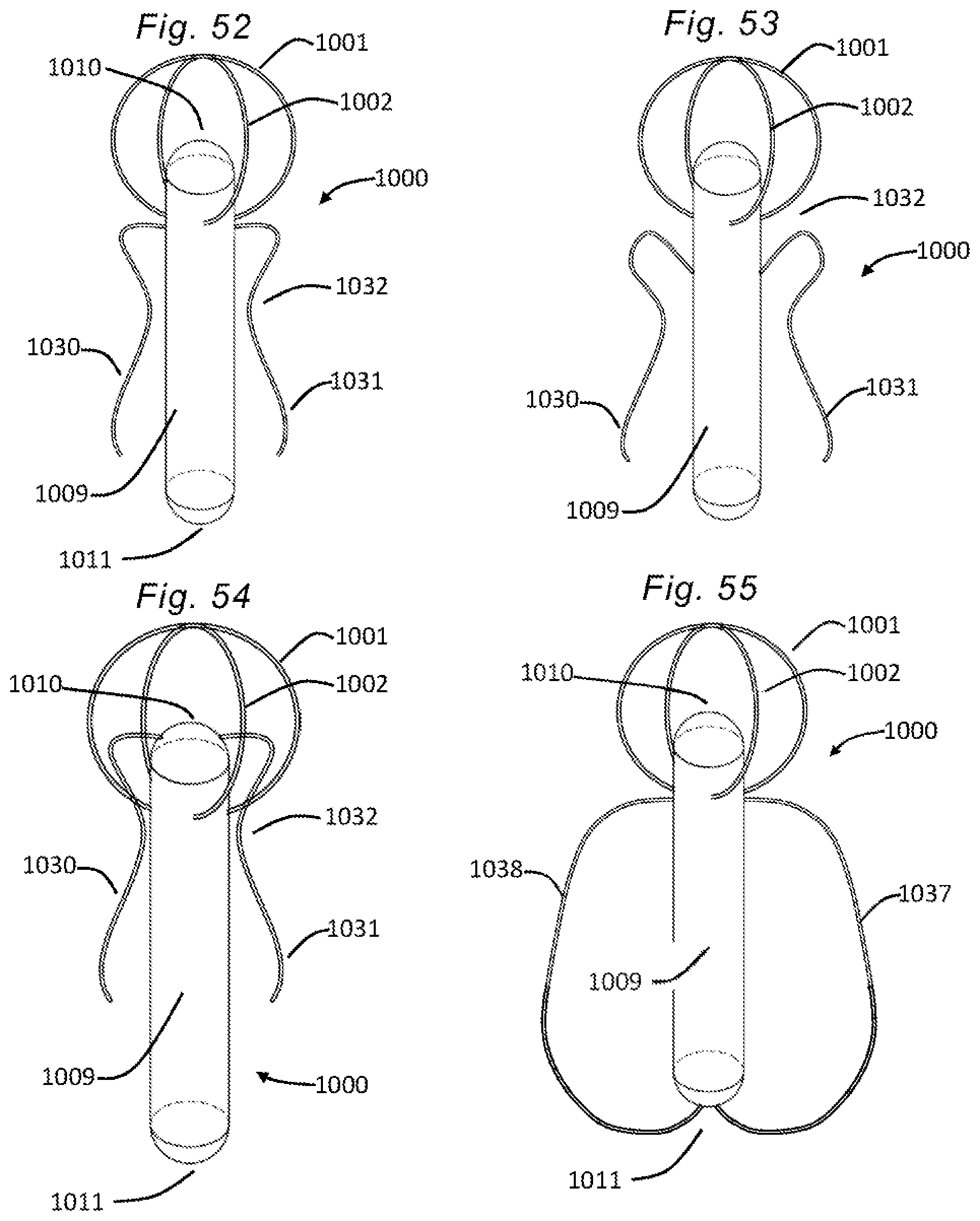 Patent US12318294 Figure 20 – Tissue grasping devices and related methods