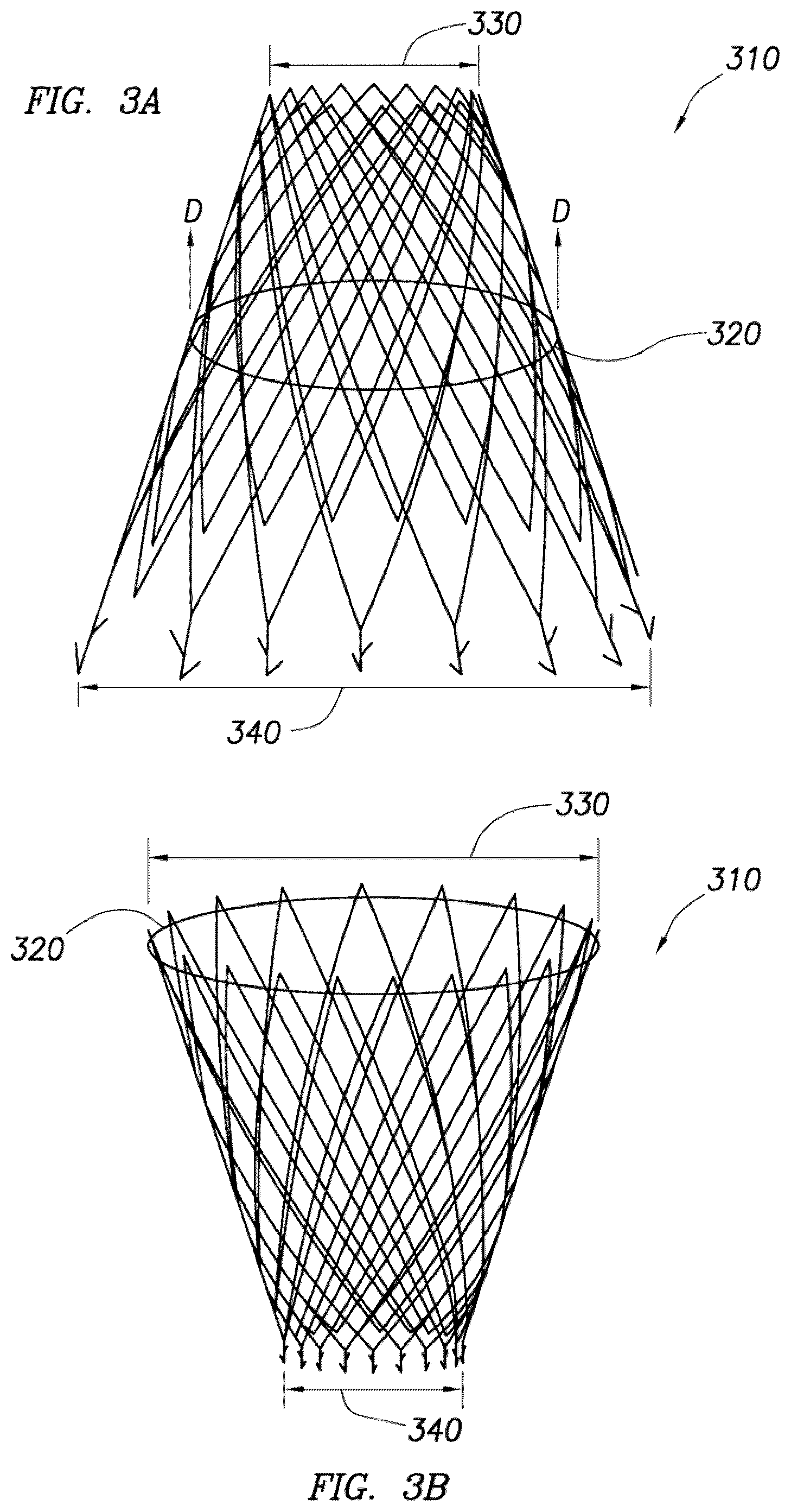 Patent US12318295 Figure 9 – Cardiac prosthesis