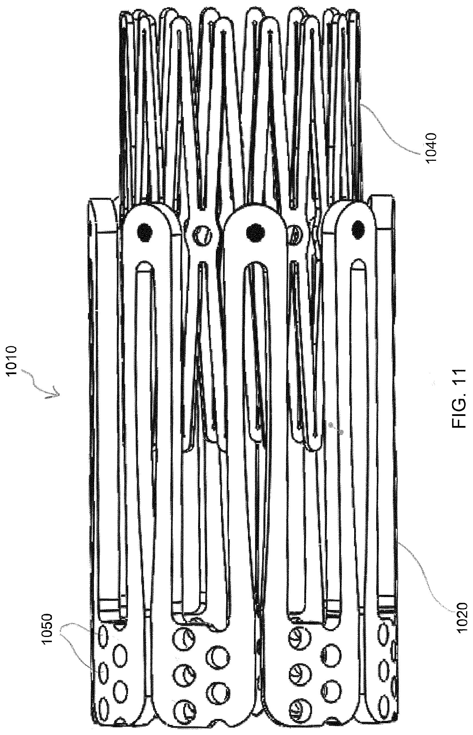 Patent US12318295 Figure 17 – Cardiac prosthesis