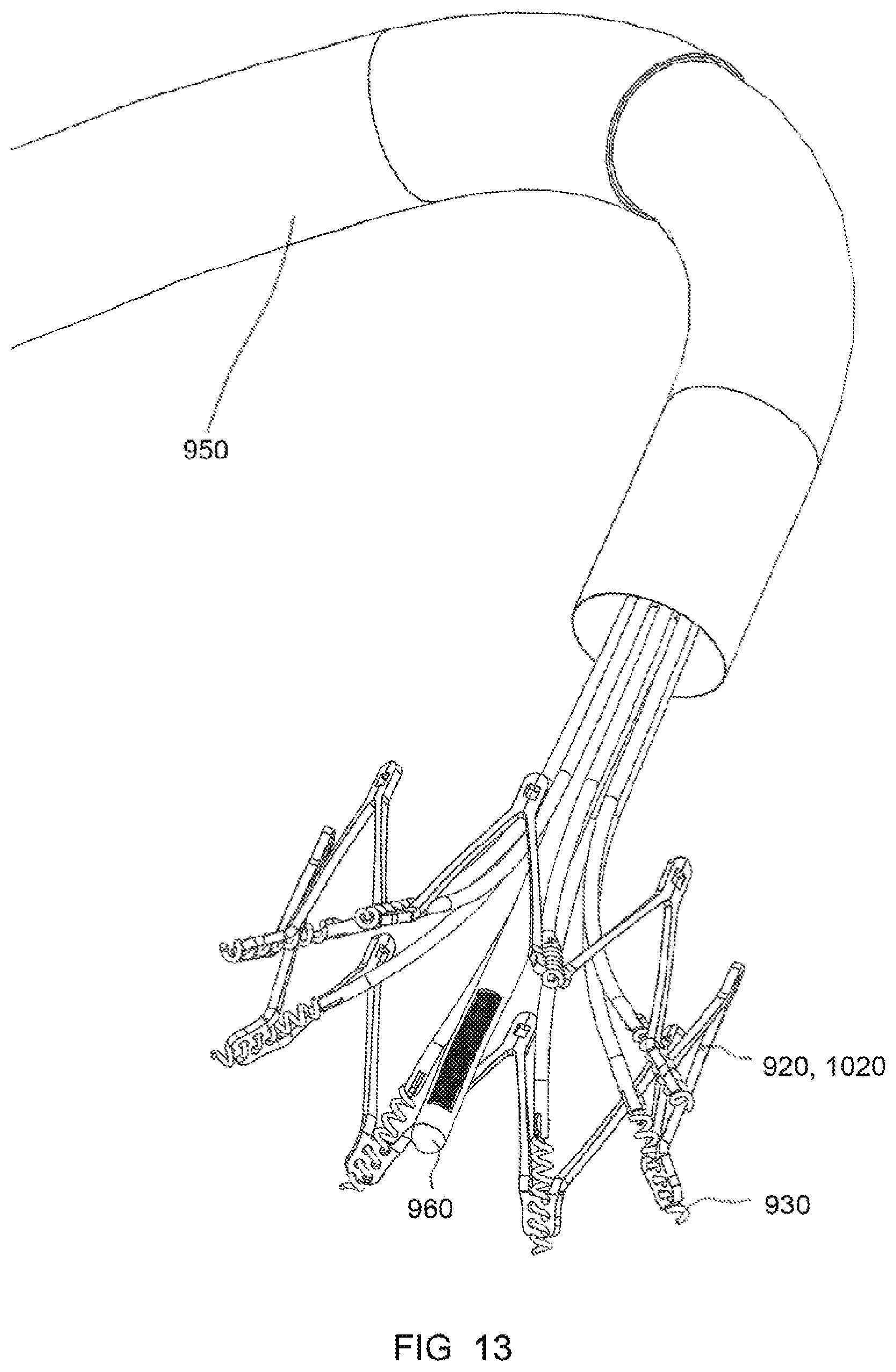 Patent US12318295 Figure 19 – Cardiac prosthesis