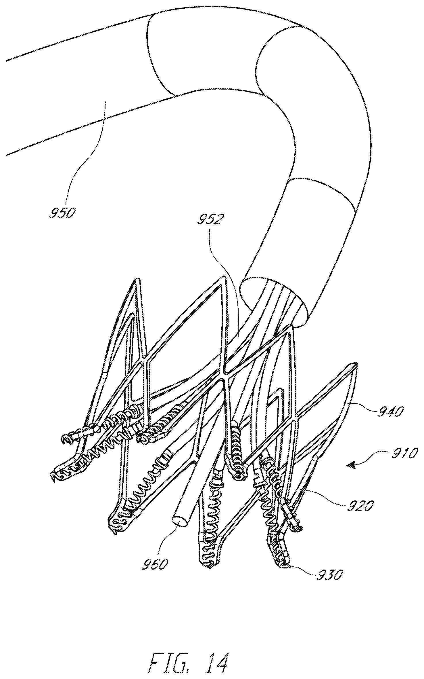 Patent US12318295 Figure 20 – Cardiac prosthesis