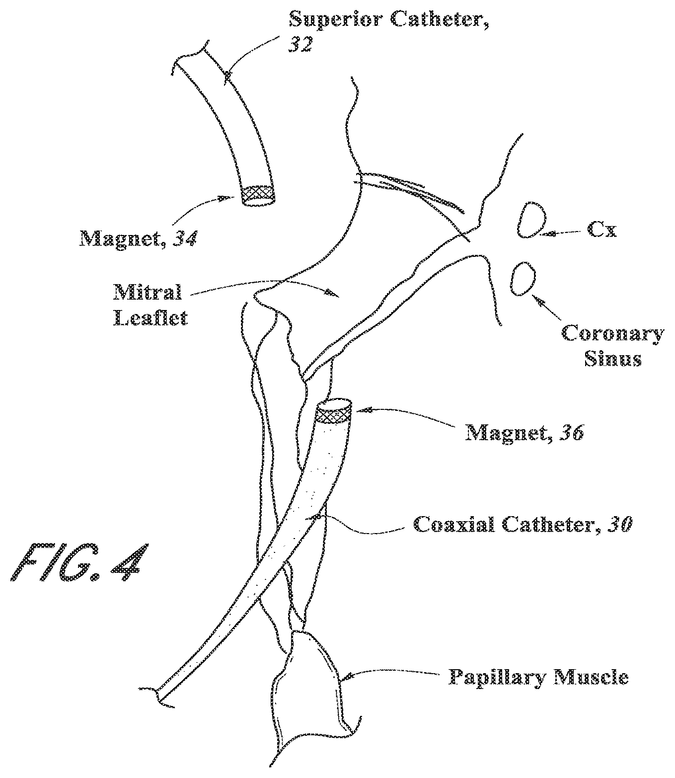 Patent US12318296 Figure 6 – Mitral leaflet tethering