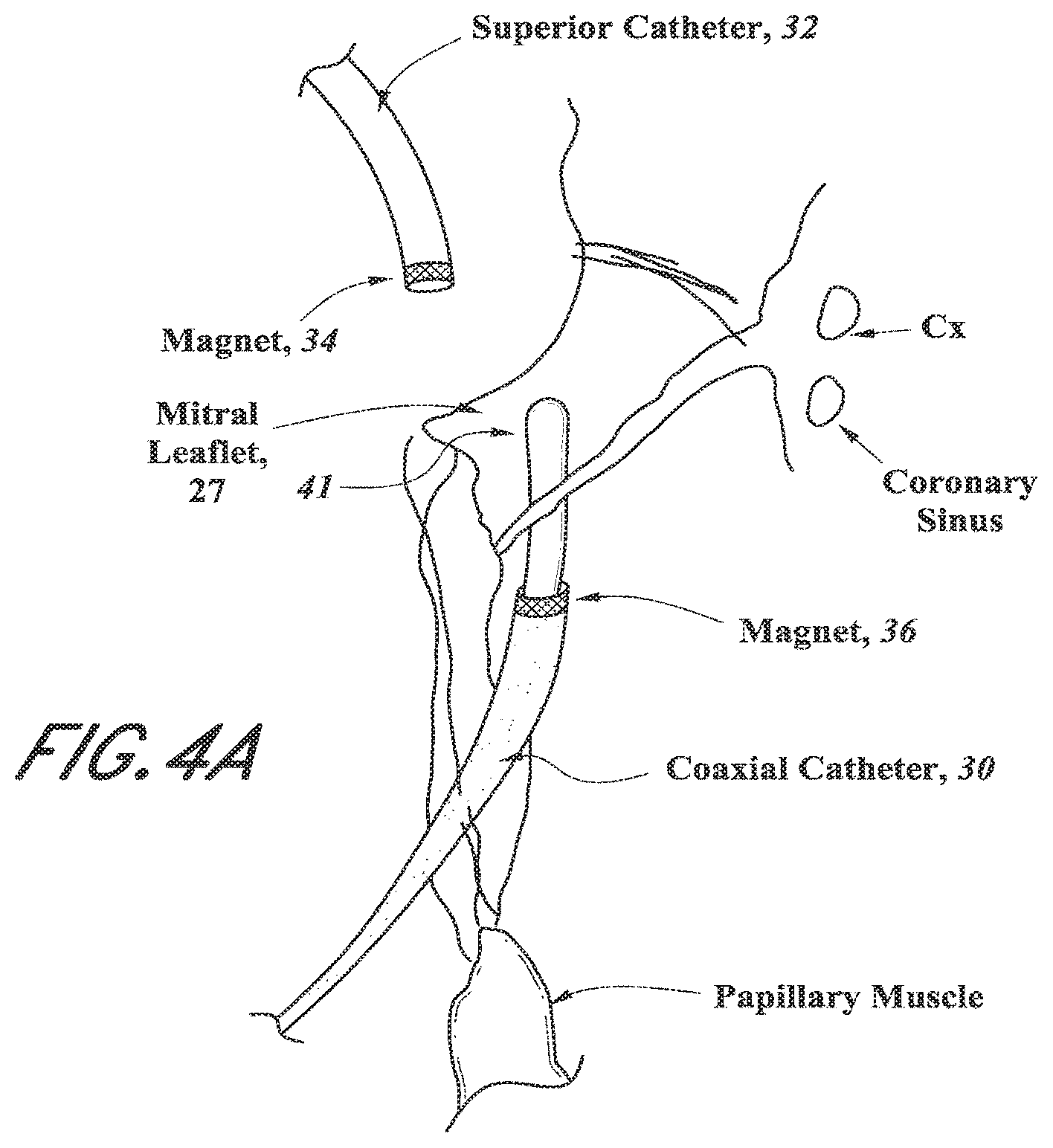 Patent US12318296 Figure 7 – Mitral leaflet tethering