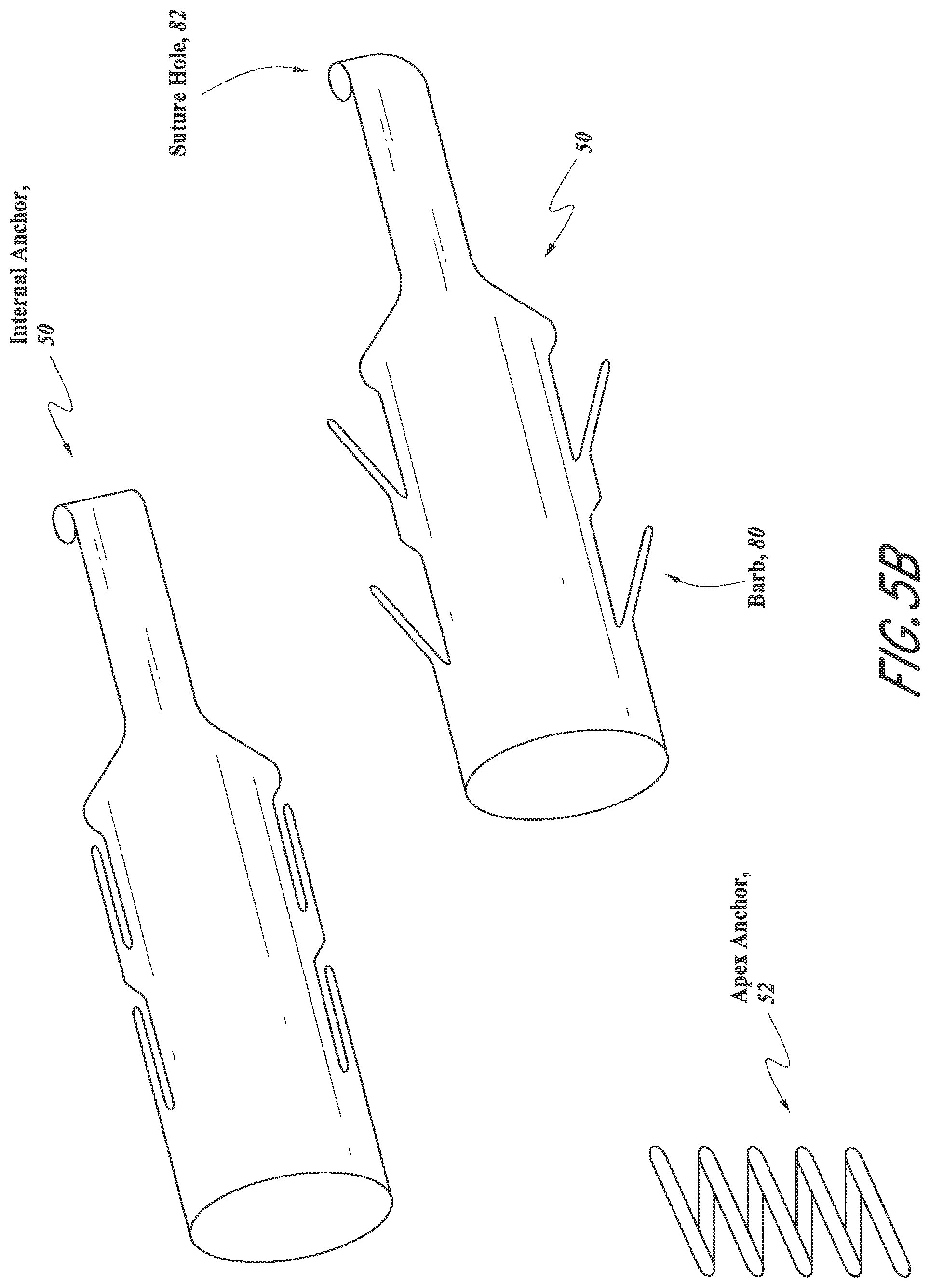 Patent US12318296 Figure 11 – Mitral leaflet tethering