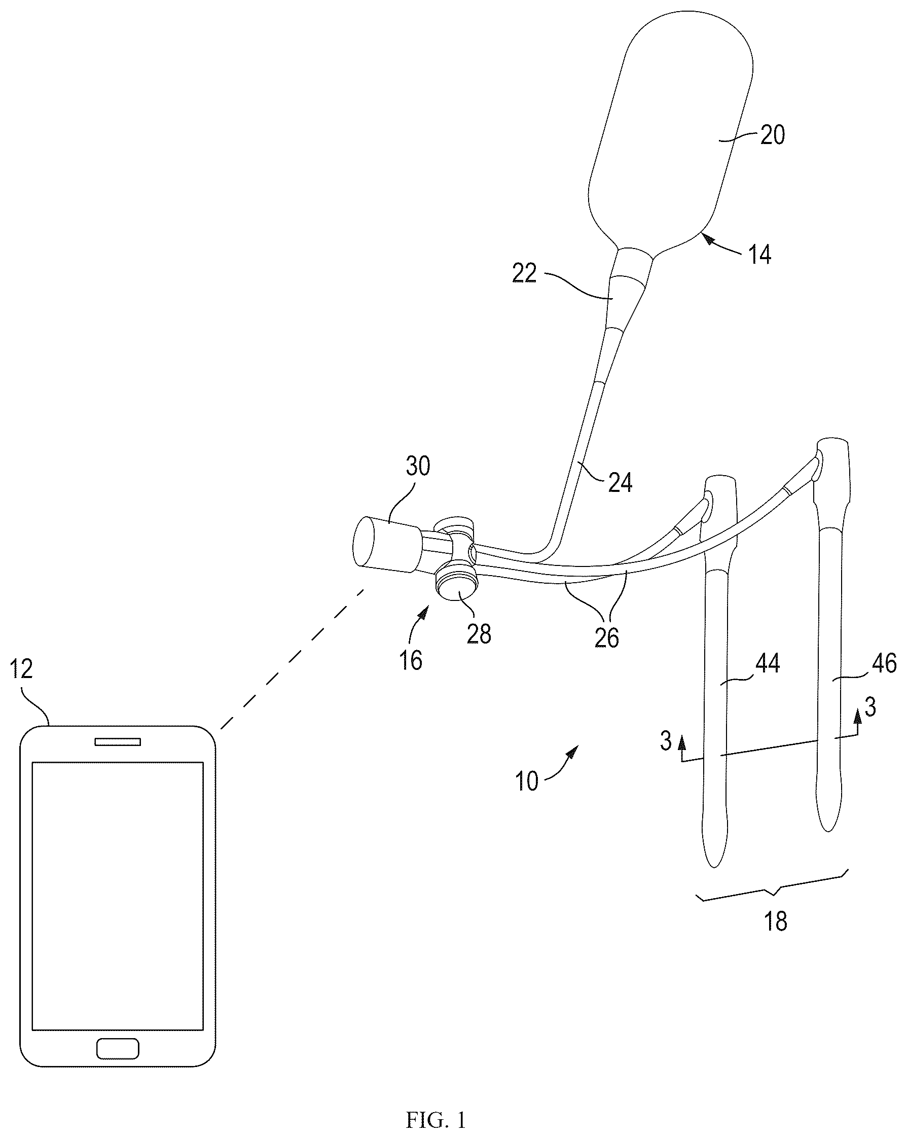 Patent US12318297 Figure 1 – Penile implant and method of implantation