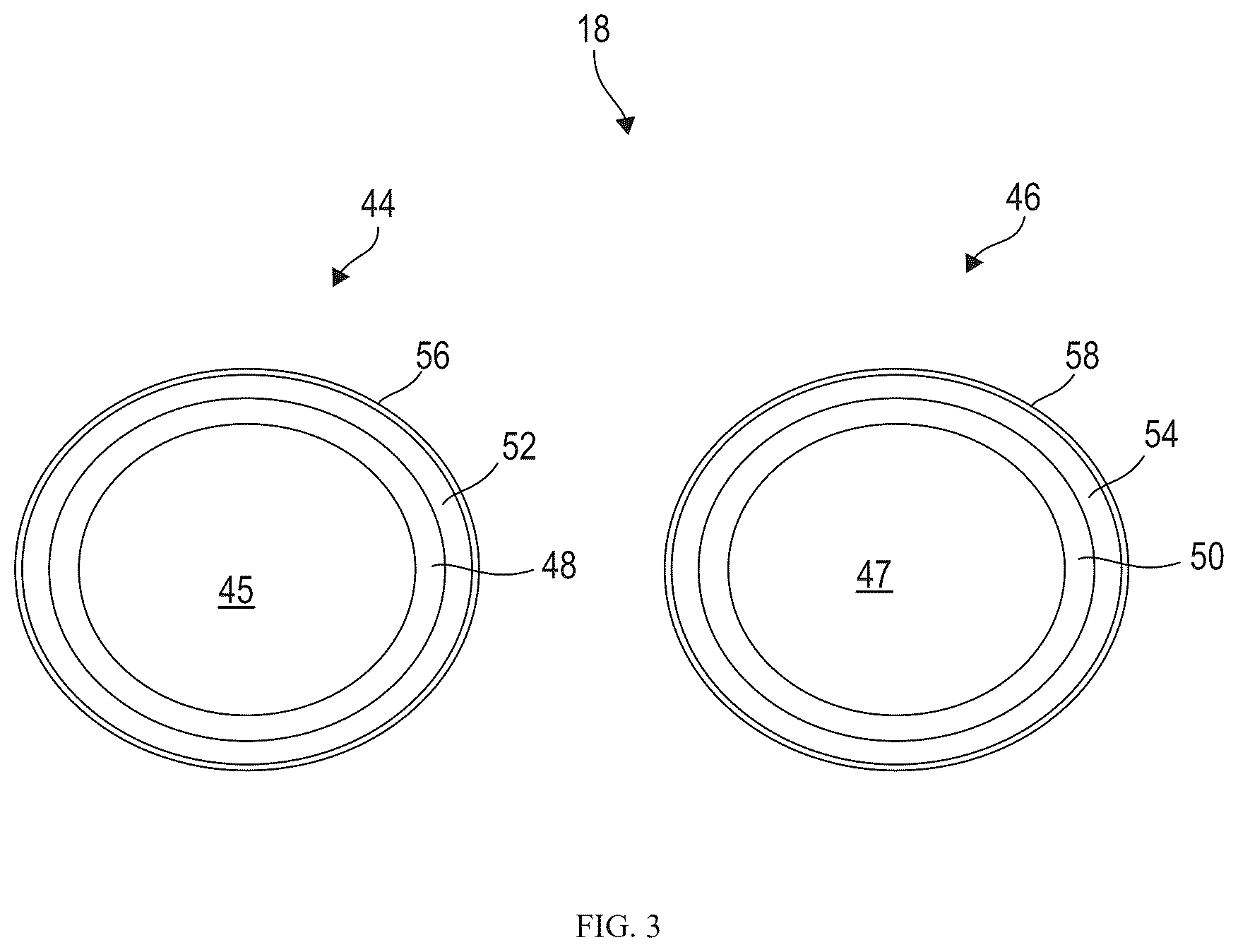 Patent US12318297 Figure 3 – Penile implant and method of implantation