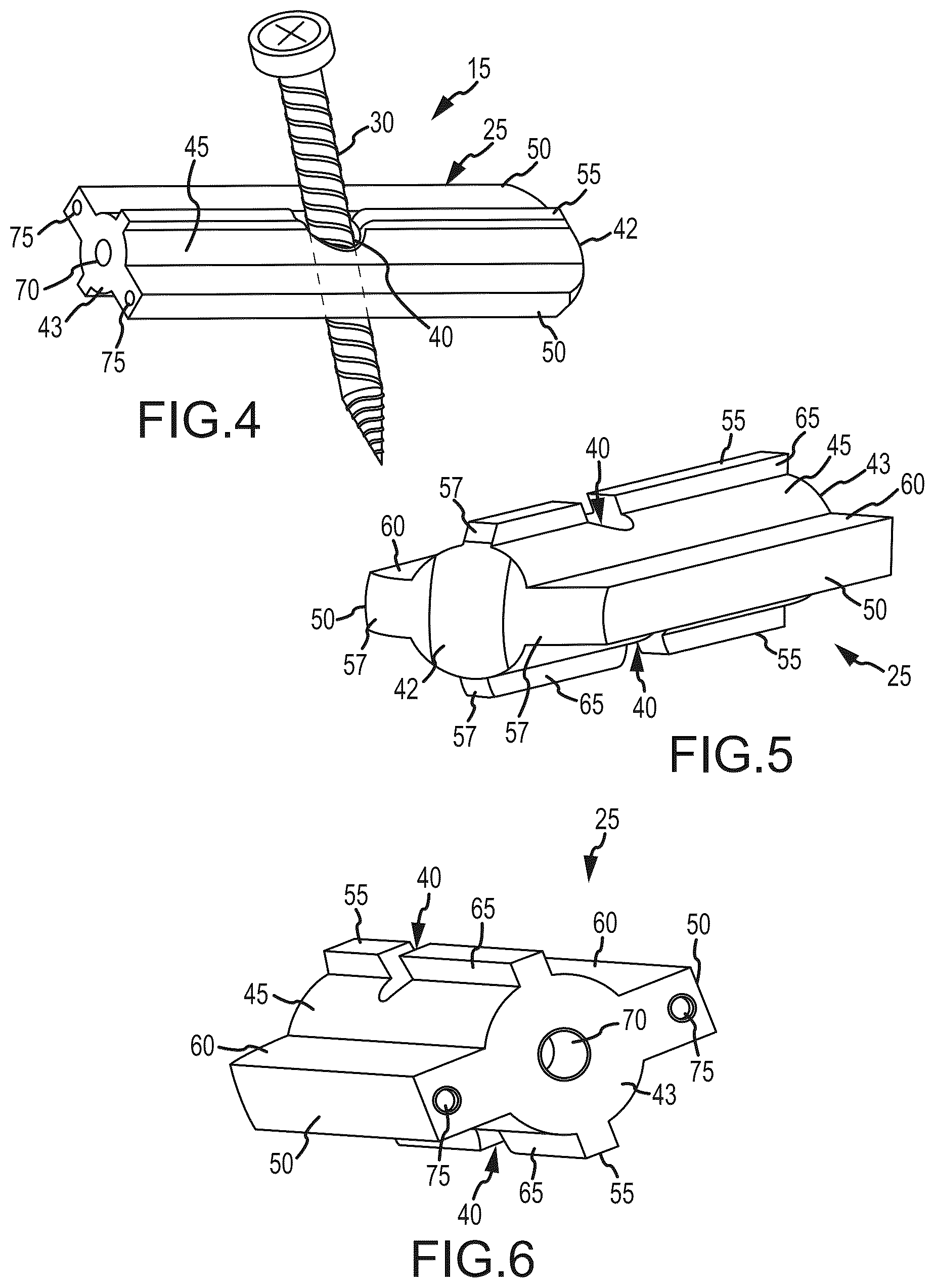 Patent US12318298 Figure 3 – Sacropelvic fusion implant system for providing a foundation for spinopelvic fixation constructs in adult spinal deformity surgery