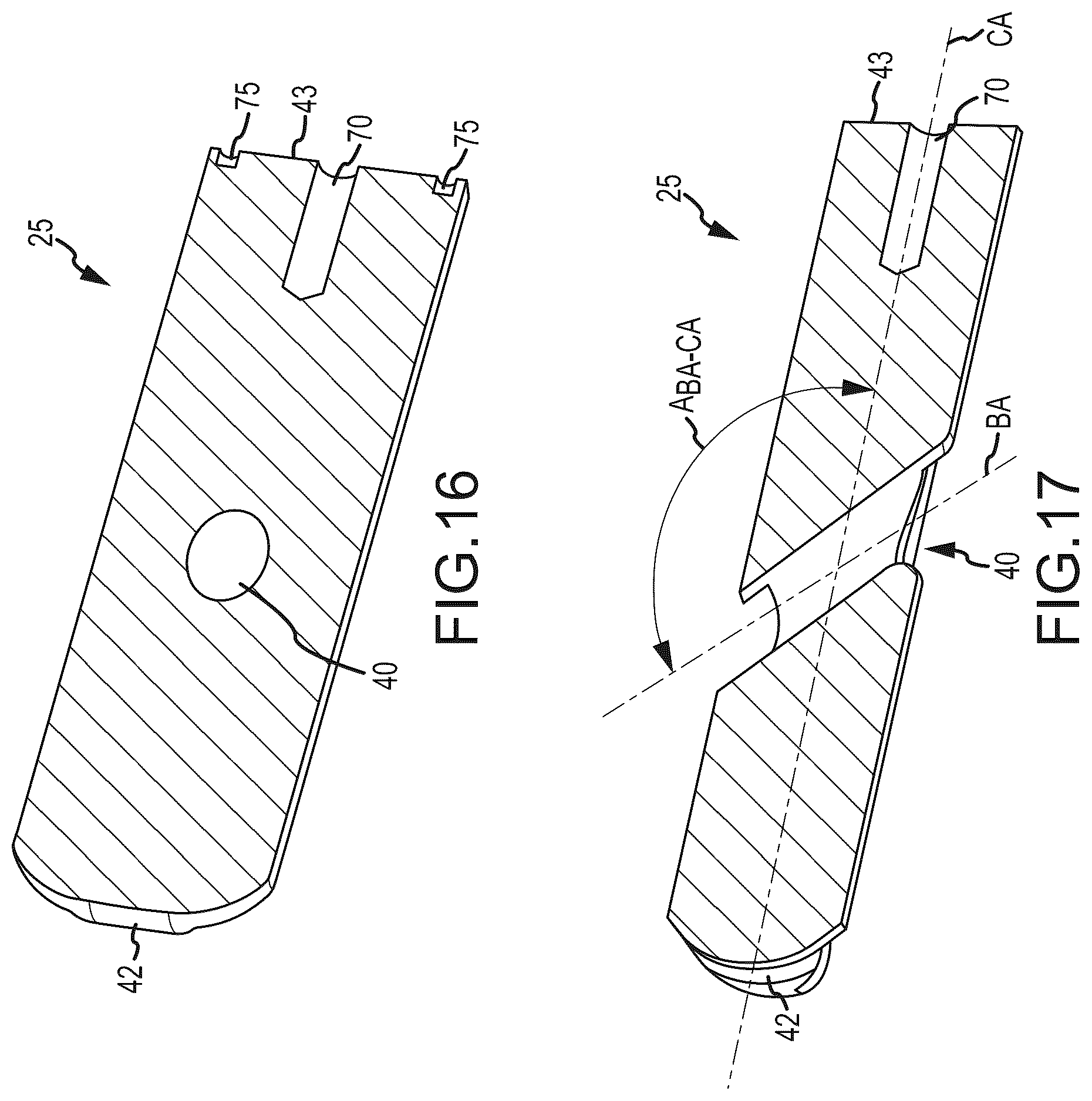 Patent US12318298 Figure 7 – Sacropelvic fusion implant system for providing a foundation for spinopelvic fixation constructs in adult spinal deformity surgery