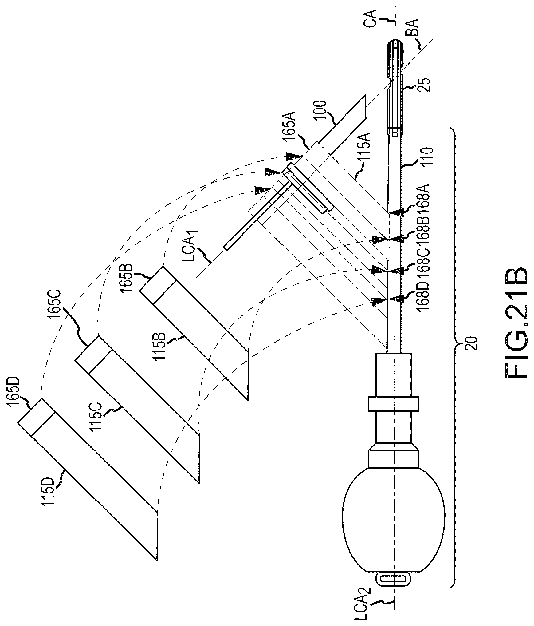 Patent US12318298 Figure 11 – Sacropelvic fusion implant system for providing a foundation for spinopelvic fixation constructs in adult spinal deformity surgery
