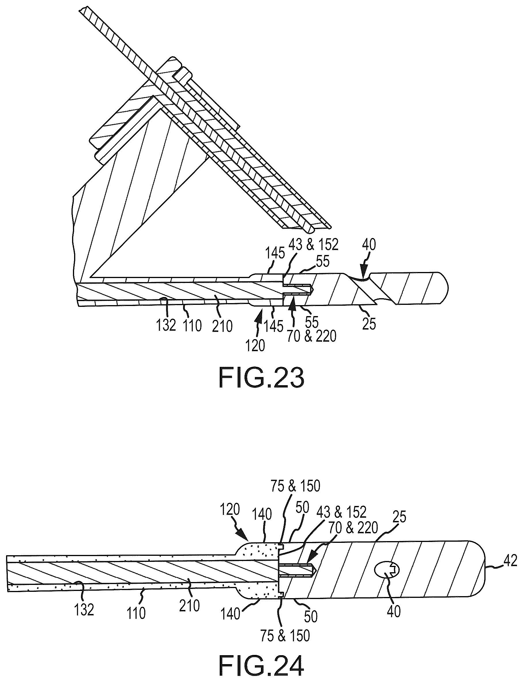 Patent US12318298 Figure 14 – Sacropelvic fusion implant system for providing a foundation for spinopelvic fixation constructs in adult spinal deformity surgery