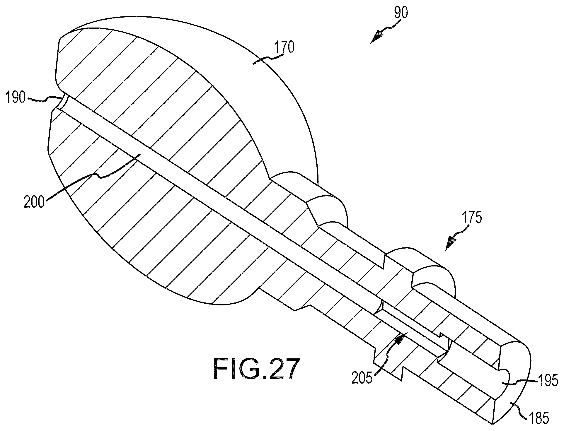 Patent US12318298 Figure 16 – Sacropelvic fusion implant system for providing a foundation for spinopelvic fixation constructs in adult spinal deformity surgery