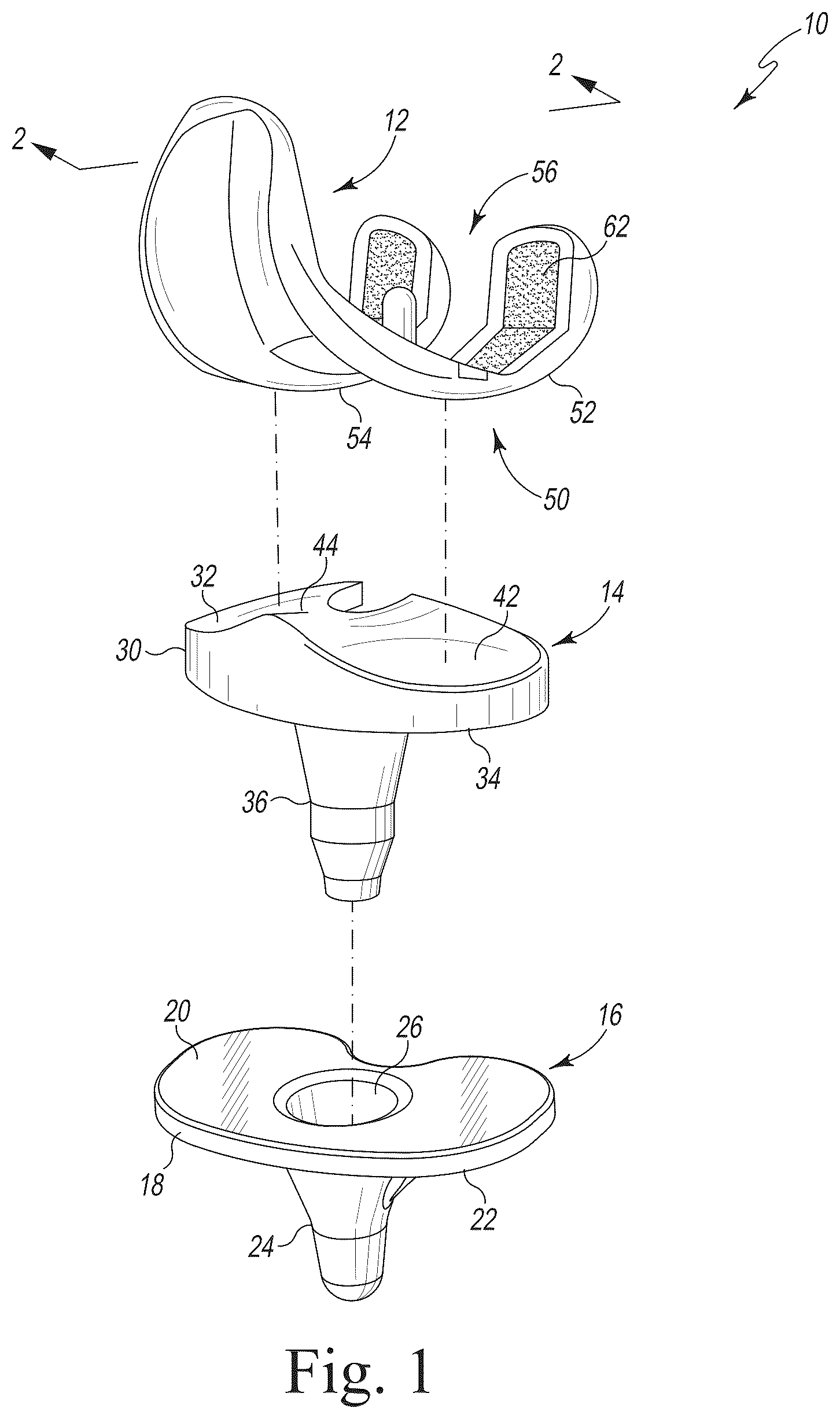 Patent US12318299 Figure 1 – Coated implant and method of making the same