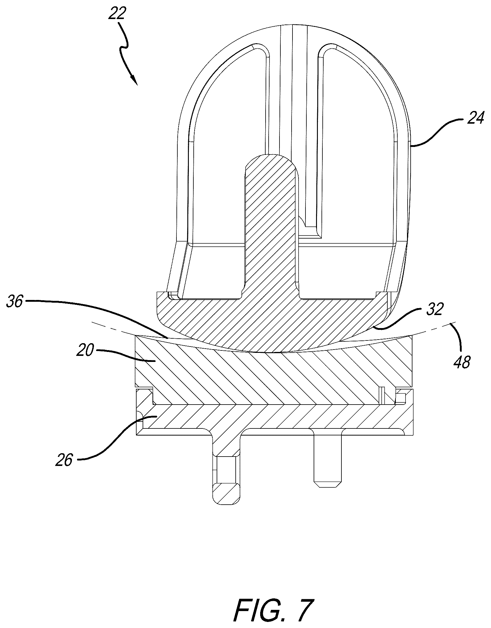 Patent US12318300 Figure 7 – Tibial insert with variable articular surface