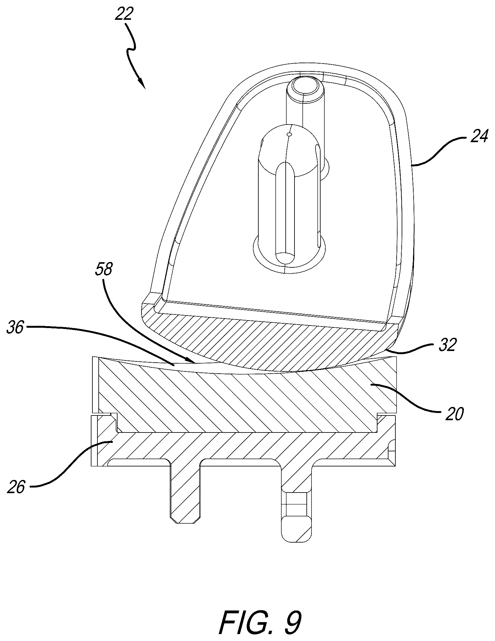 Patent US12318300 Figure 9 – Tibial insert with variable articular surface