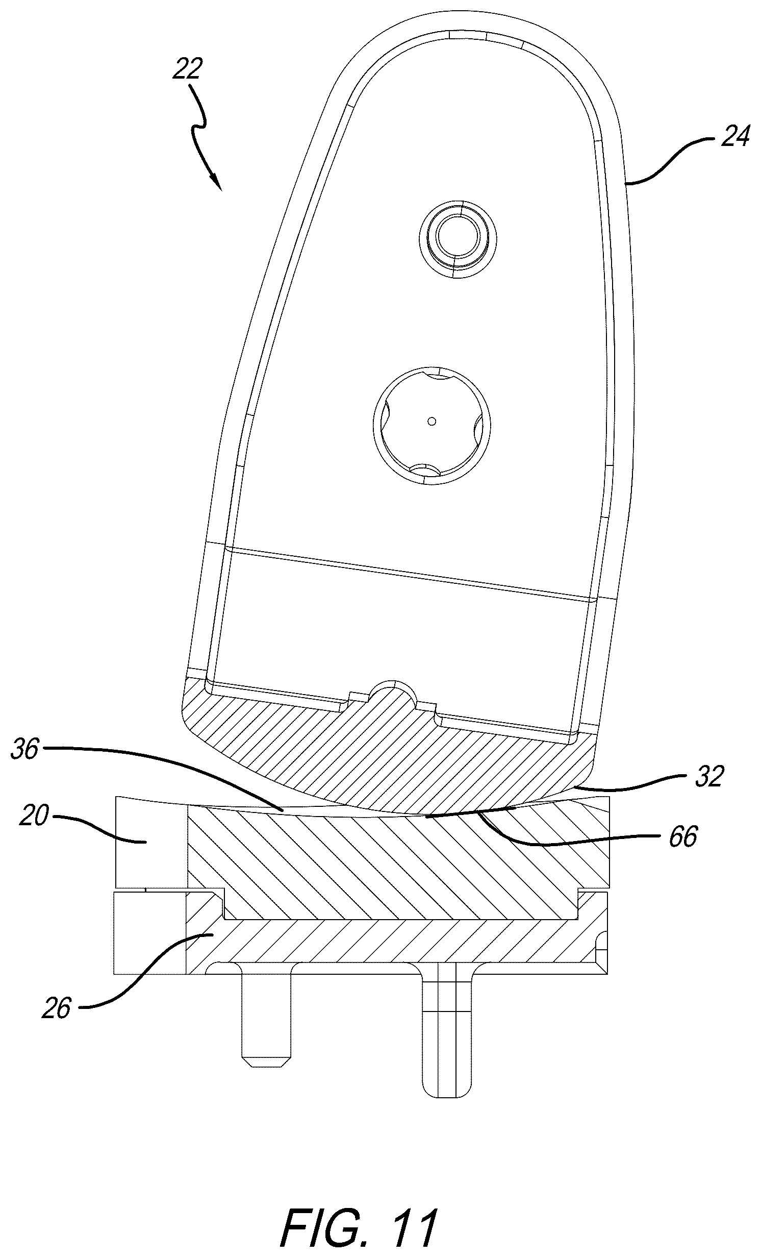 Patent US12318300 Figure 11 – Tibial insert with variable articular surface