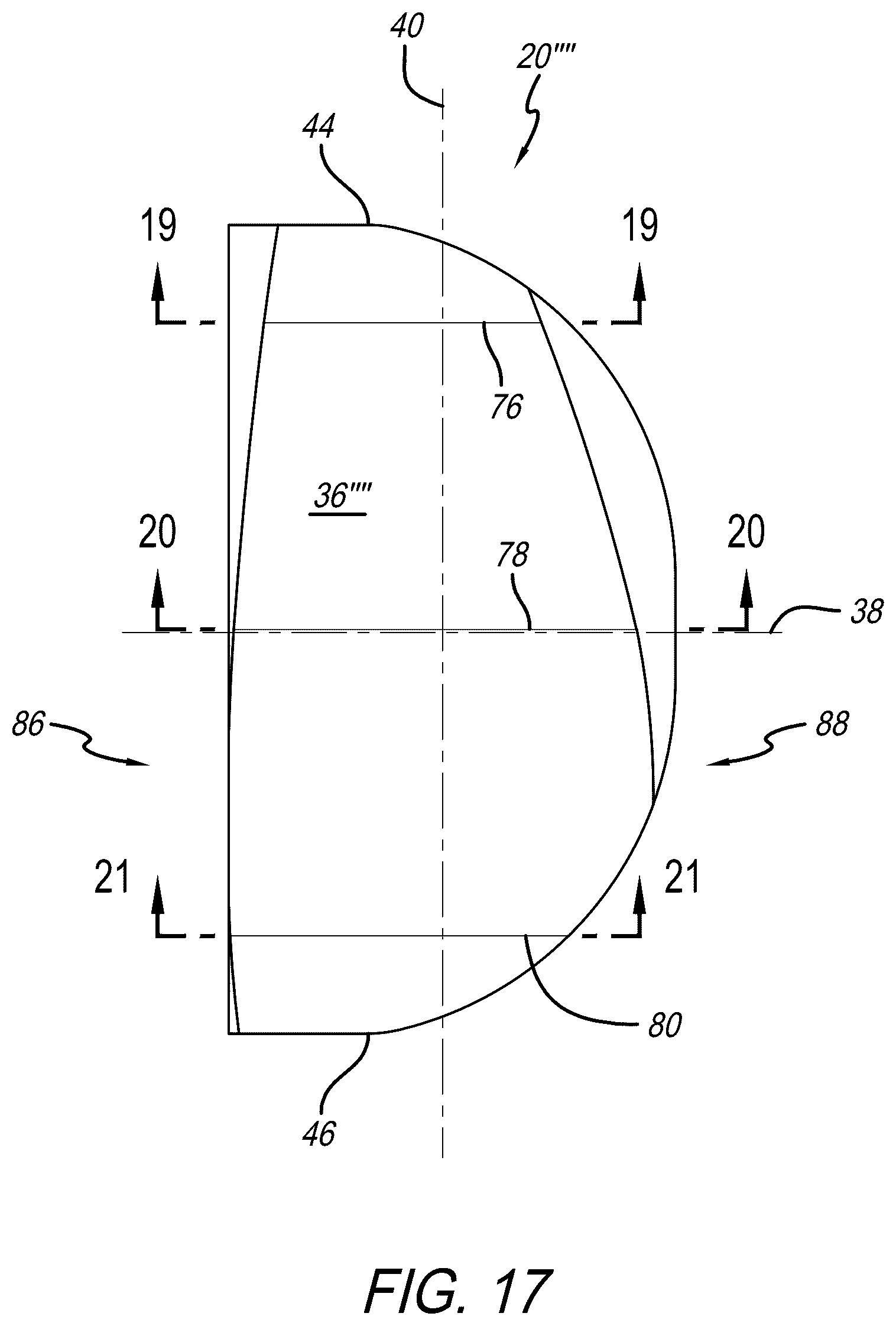 Patent US12318300 Figure 17 – Tibial insert with variable articular surface