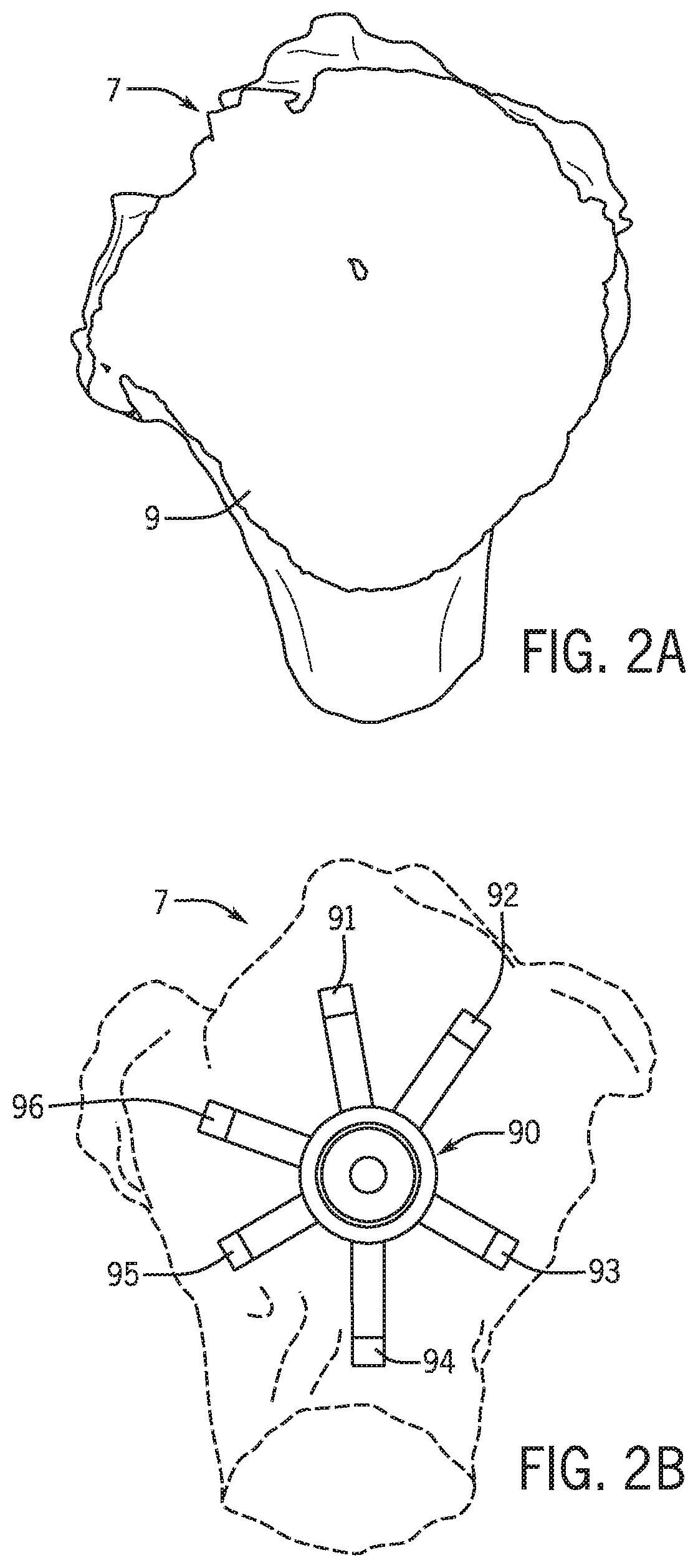 Patent US12318301 Figure 2 – Method for modeling humeral anatomy and optimization of component design
