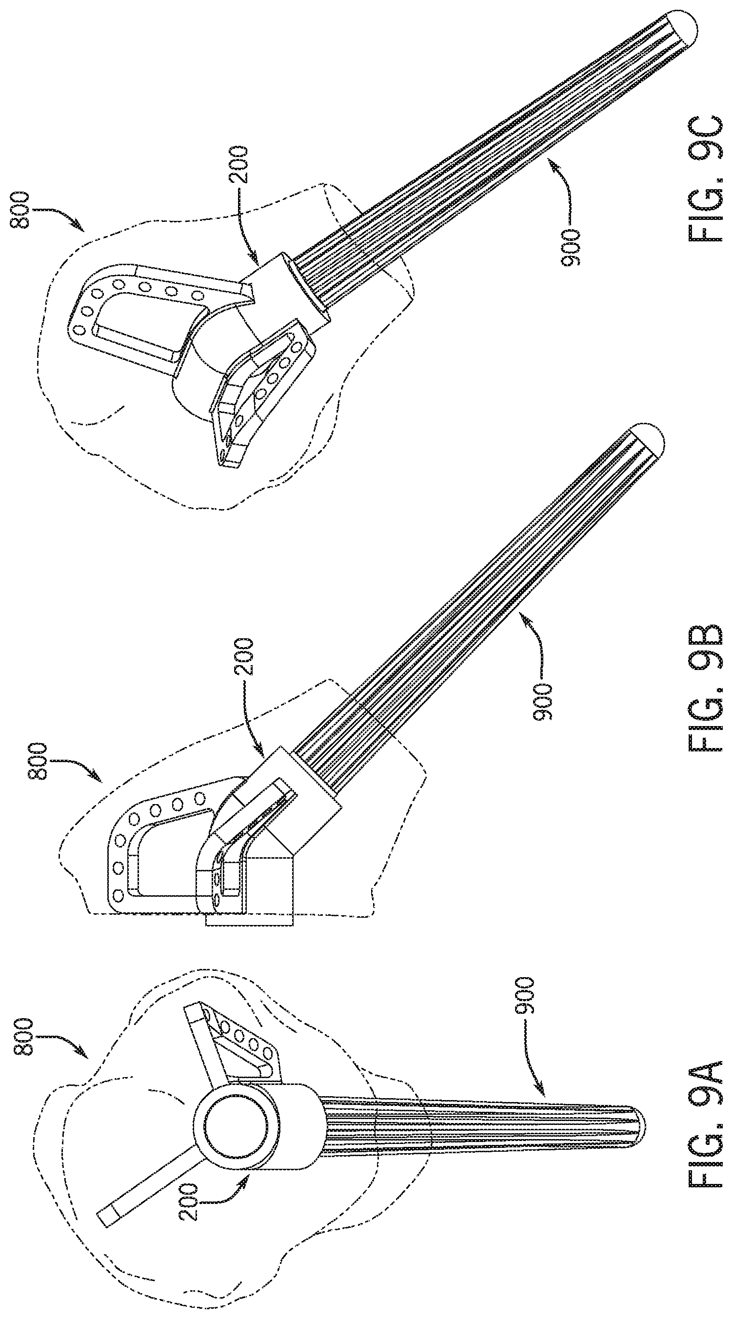 Patent US12318301 Figure 10 – Method for modeling humeral anatomy and optimization of component design