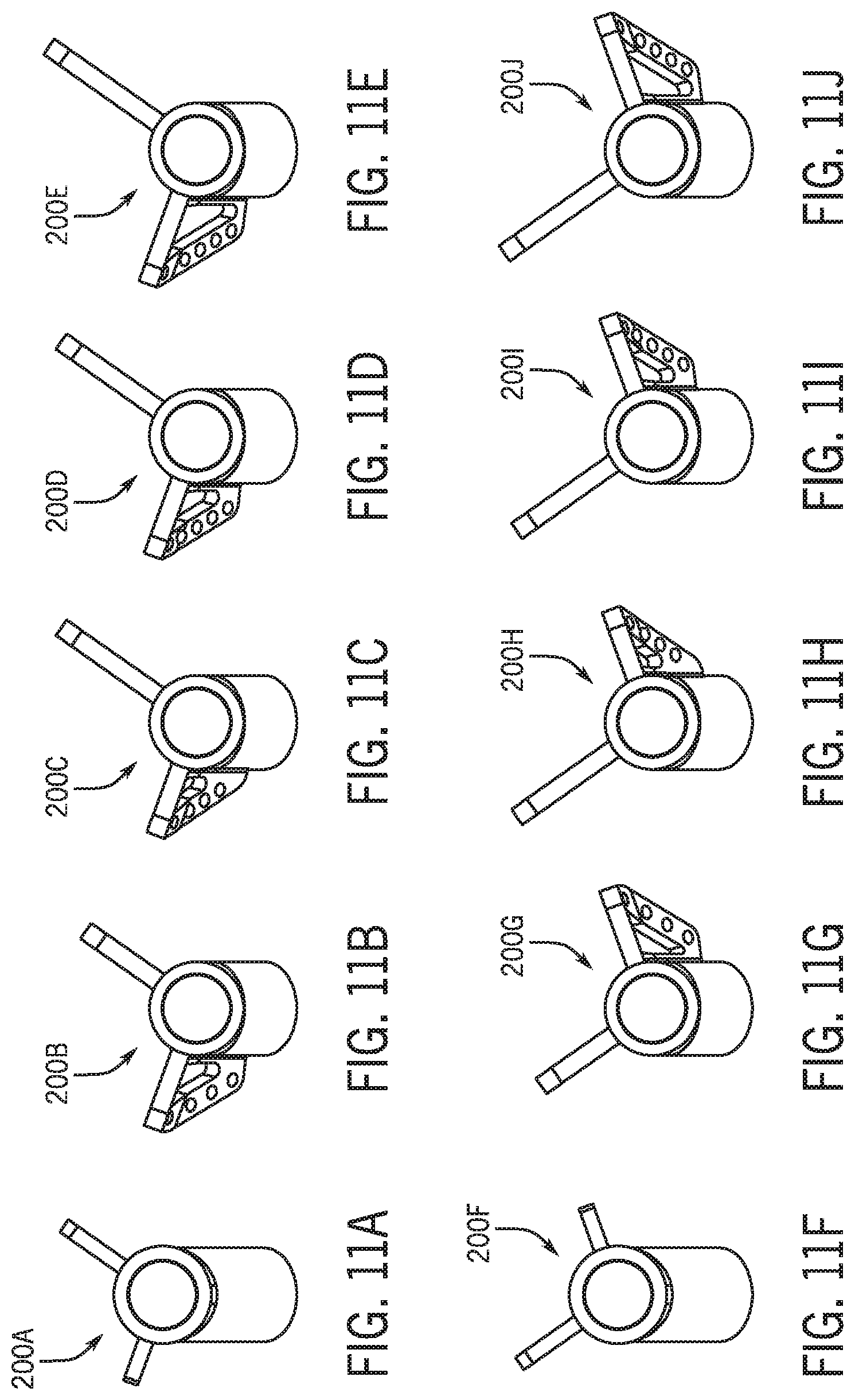 Patent US12318301 Figure 12 – Method for modeling humeral anatomy and optimization of component design
