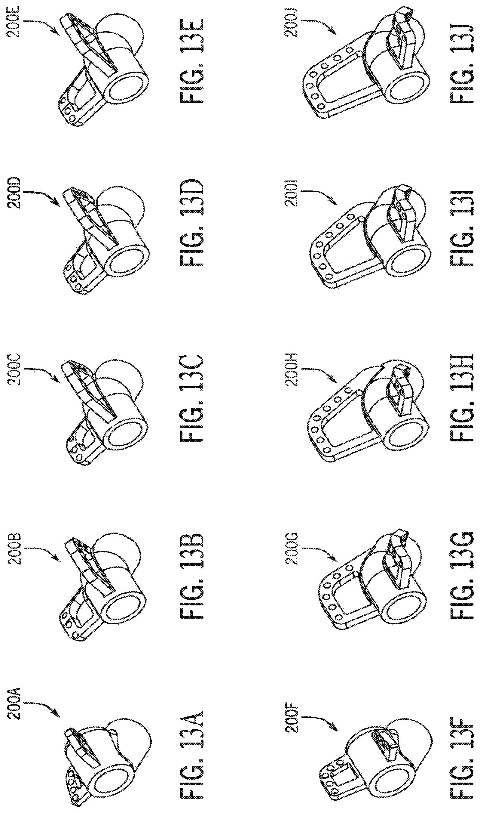 Patent US12318301 Figure 14 – Method for modeling humeral anatomy and optimization of component design