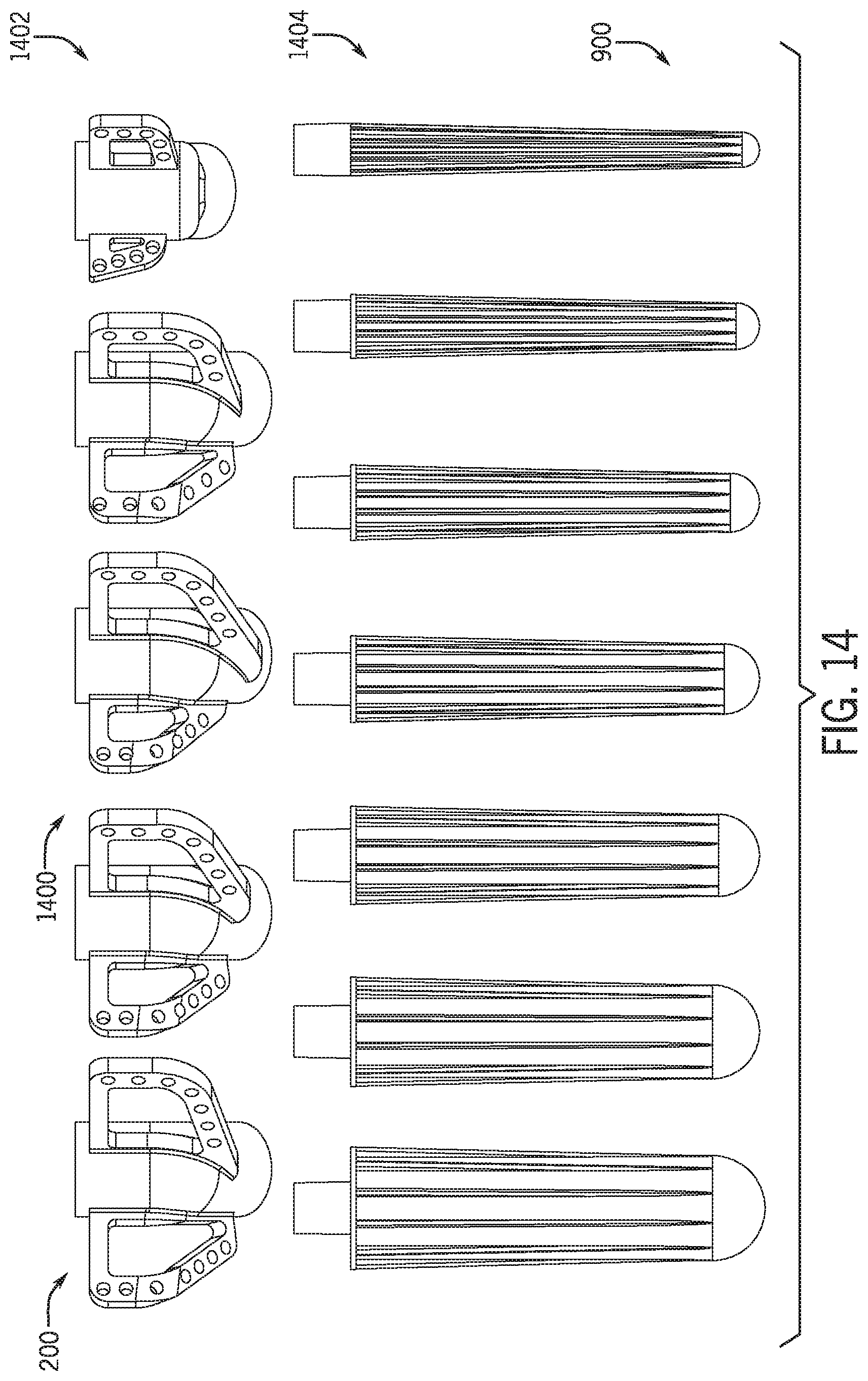 Patent US12318301 Figure 15 – Method for modeling humeral anatomy and optimization of component design