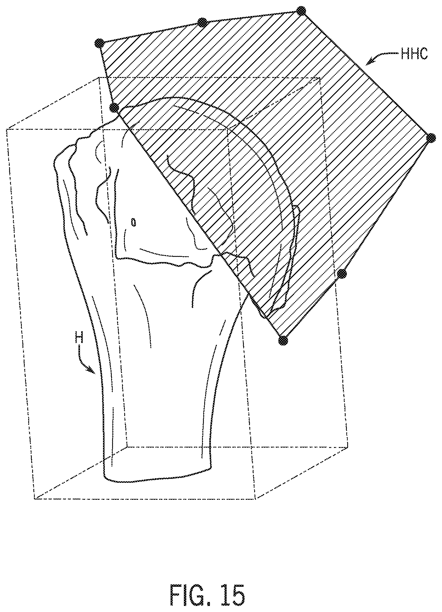 Patent US12318301 Figure 16 – Method for modeling humeral anatomy and optimization of component design