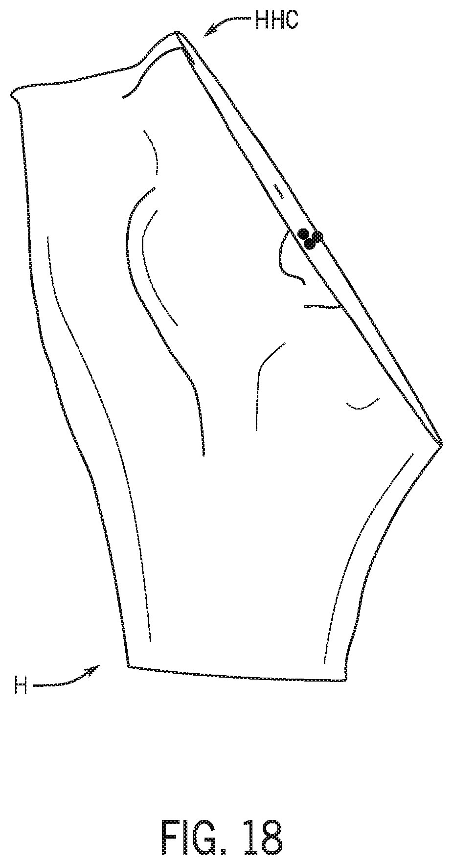 Patent US12318301 Figure 18 – Method for modeling humeral anatomy and optimization of component design