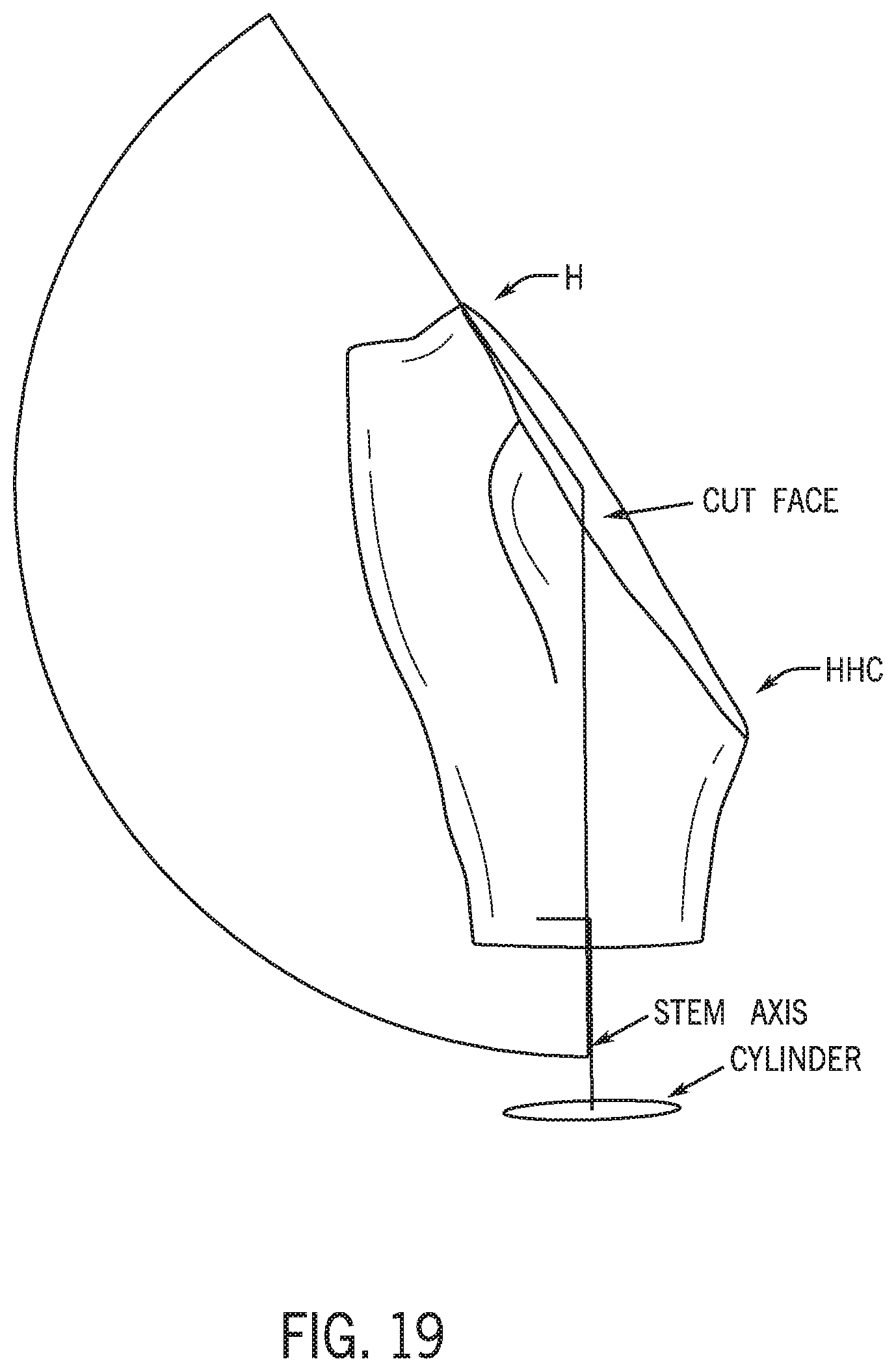 Patent US12318301 Figure 19 – Method for modeling humeral anatomy and optimization of component design