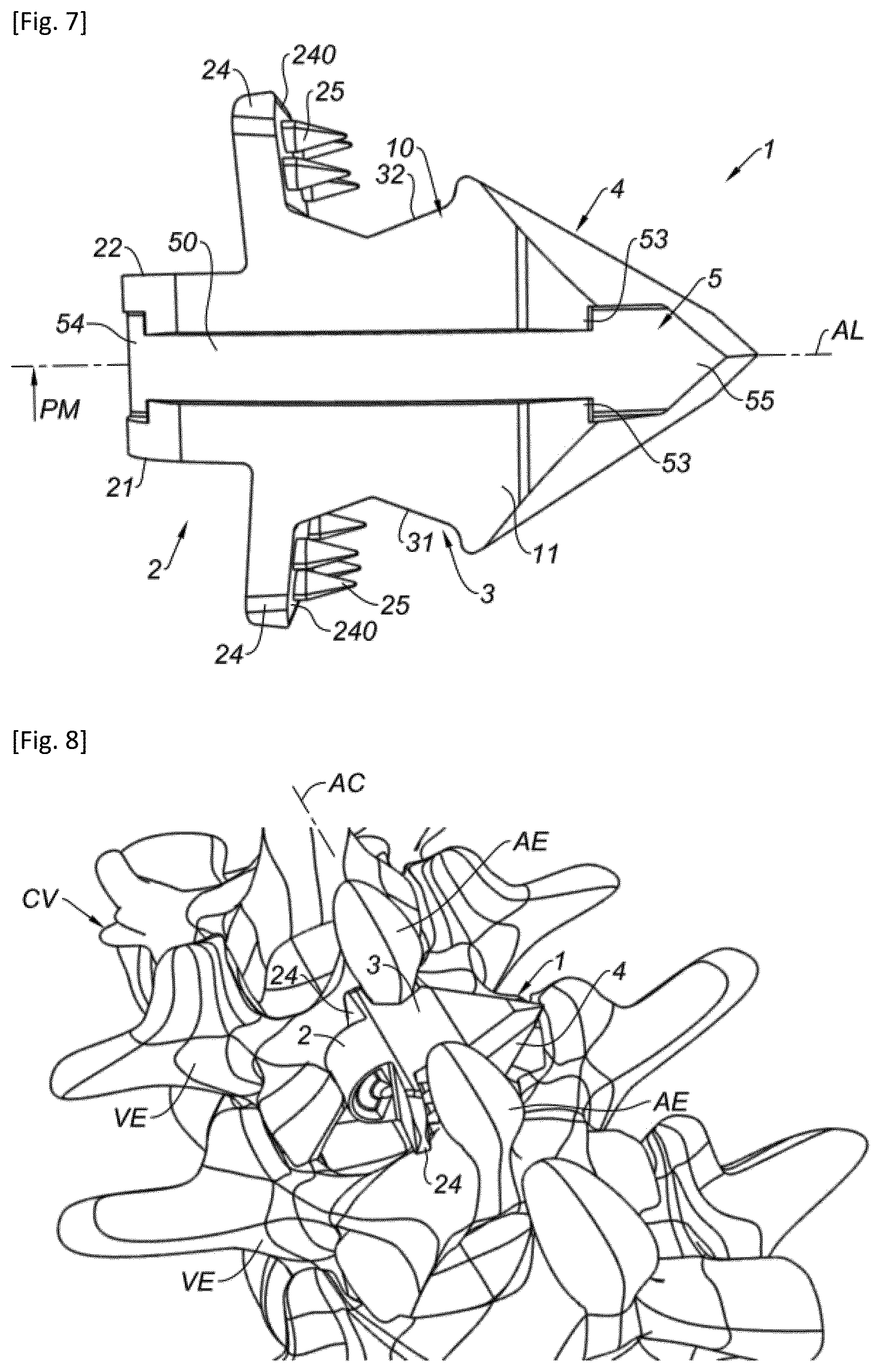 Patent US12318302 Figure 3 – Interspinous implant and associated implantation ancillary