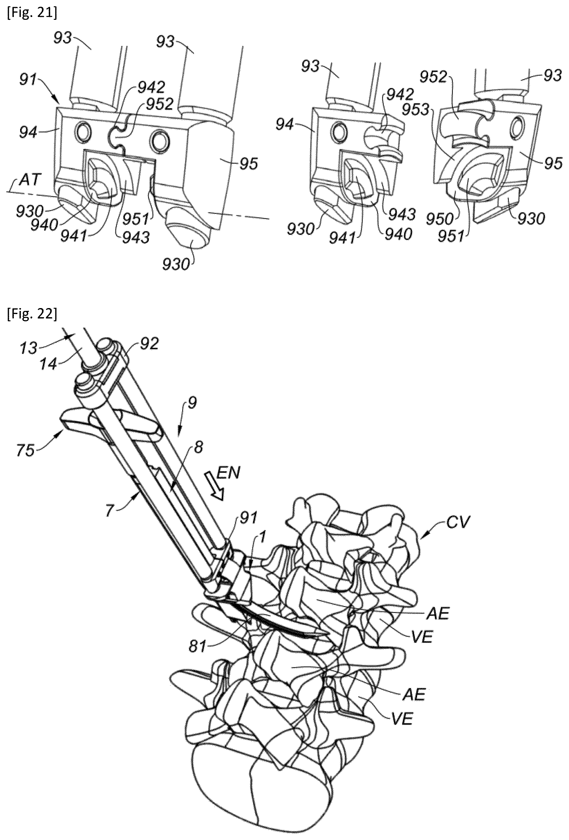 Patent US12318302 Figure 10 – Interspinous implant and associated implantation ancillary