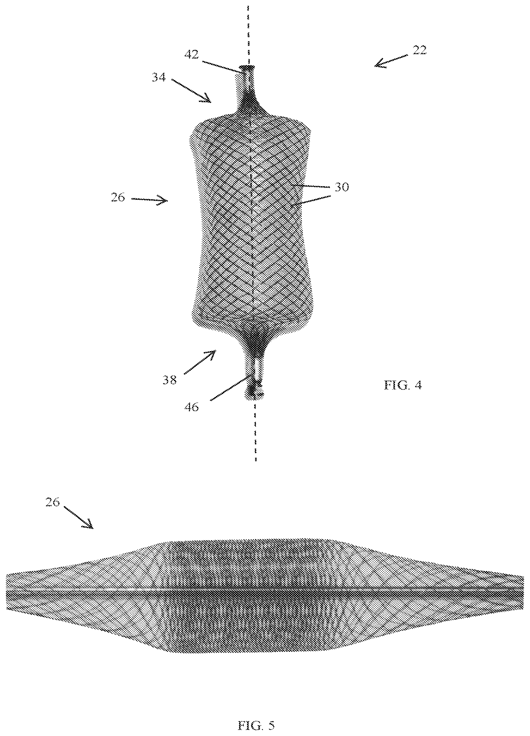 Patent US12318303 Figure 3 – Spinal disc implant and device and method for percutaneous delivery of the spinal disc implant