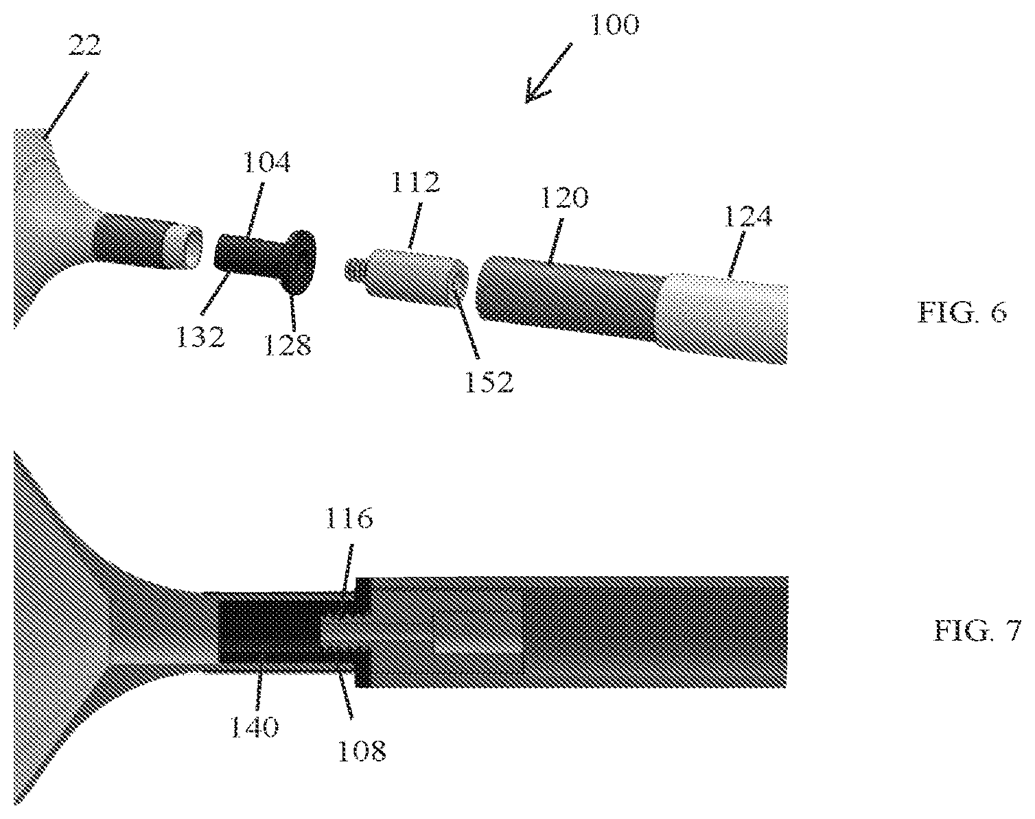 Patent US12318303 Figure 4 – Spinal disc implant and device and method for percutaneous delivery of the spinal disc implant