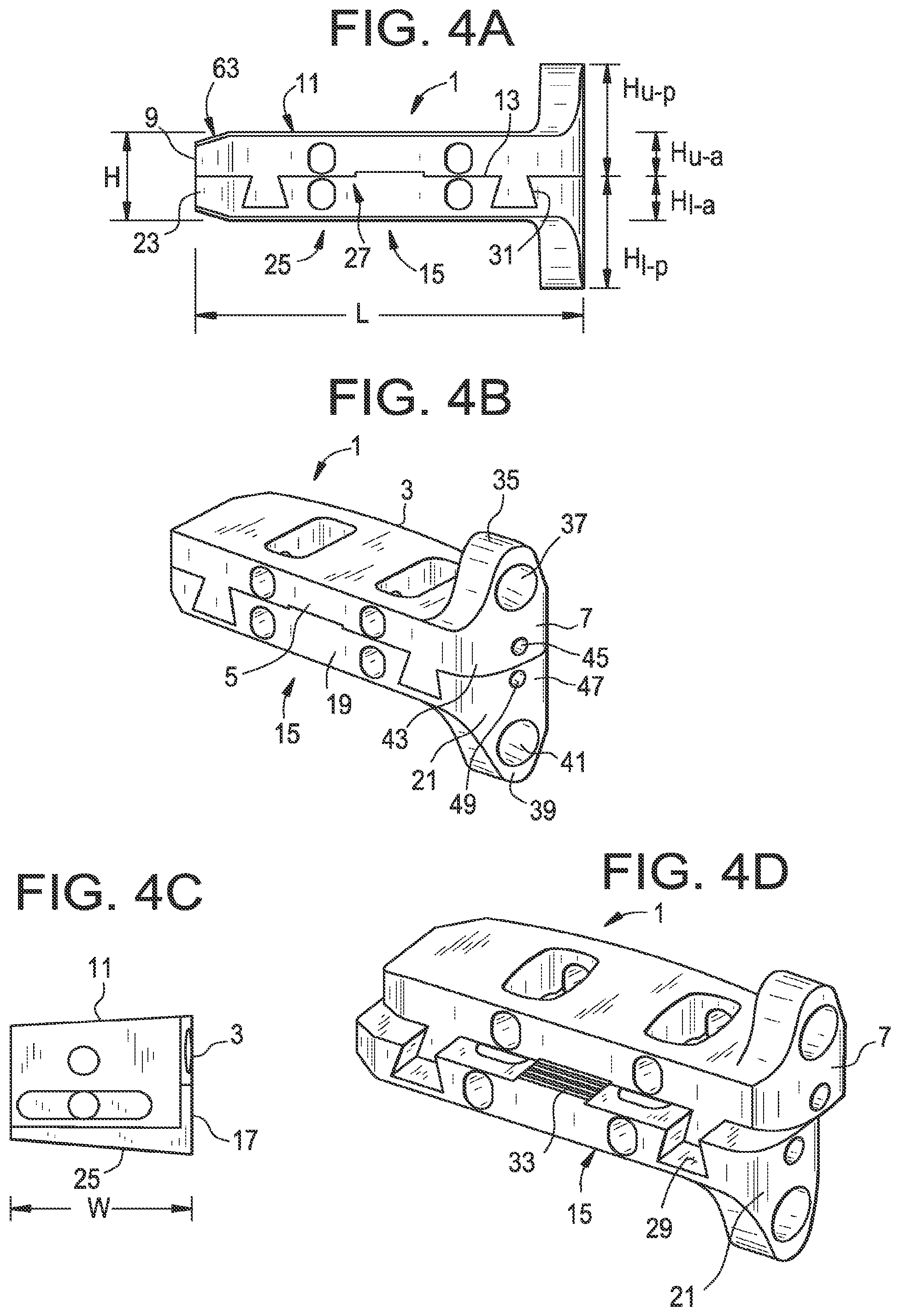 Patent US12318304 Figure 2 – Lateral spondylolisthesis reduction cage