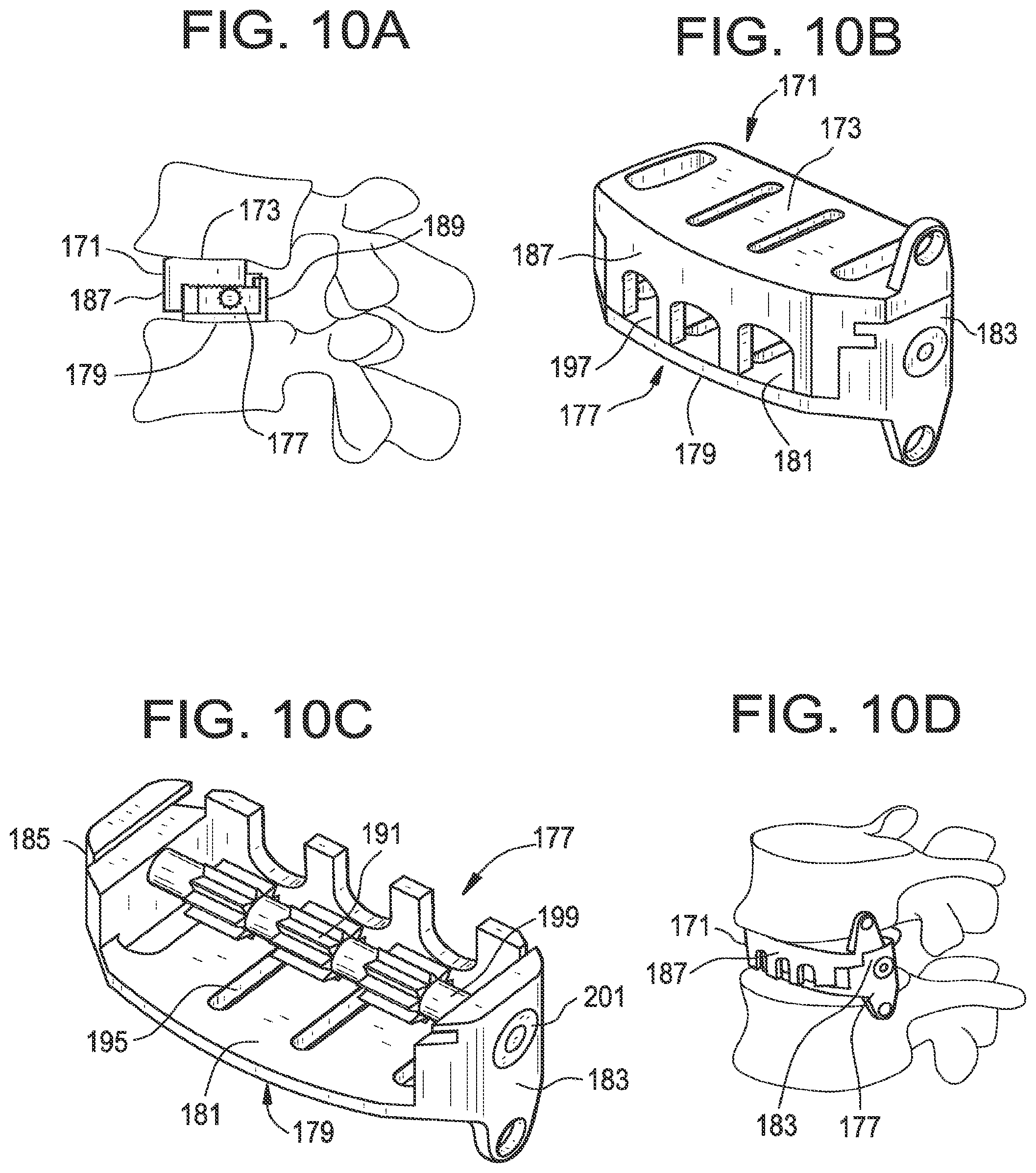 Patent US12318304 Figure 9 – Lateral spondylolisthesis reduction cage