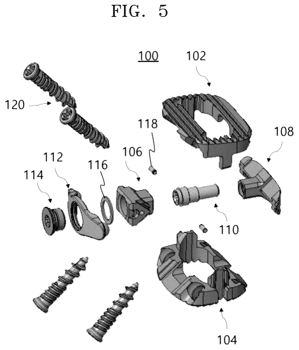 Patent US12318305 Figure 5 – Height-adjustable intervertebral fusion cage