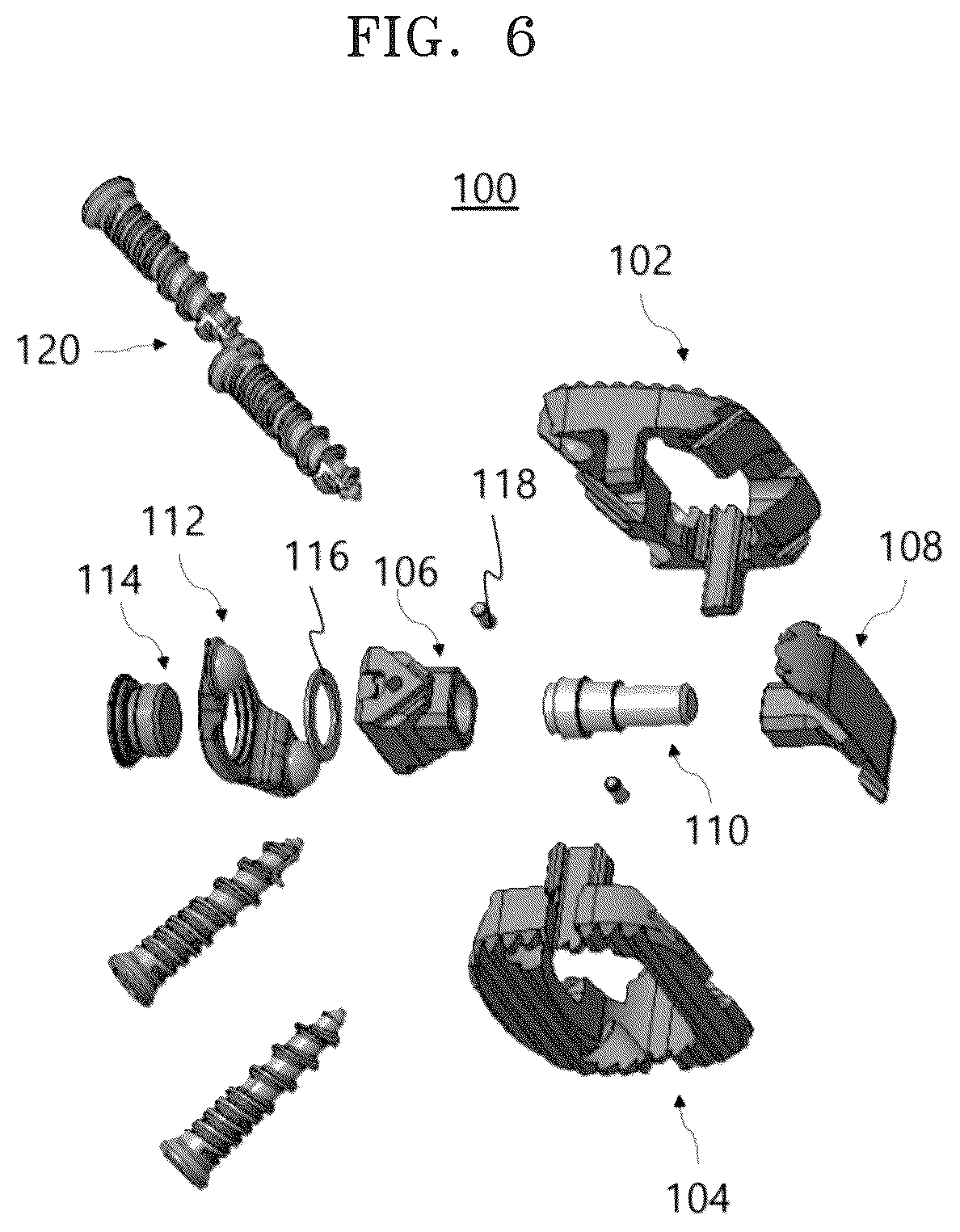 Patent US12318305 Figure 6 – Height-adjustable intervertebral fusion cage