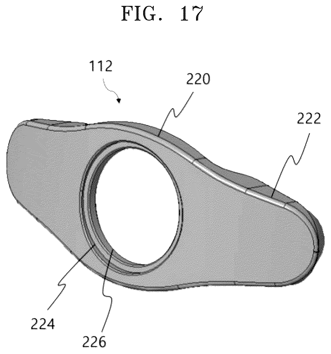 Patent US12318305 Figure 17 – Height-adjustable intervertebral fusion cage