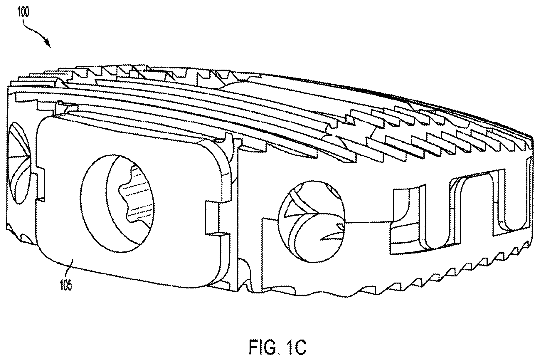 Patent US12318308 Figure 3 – Dual expandable inter-body device