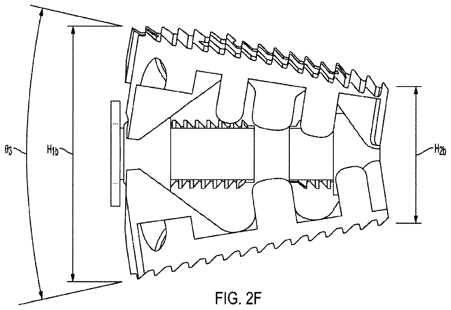 Patent US12318308 Figure 10 – Dual expandable inter-body device