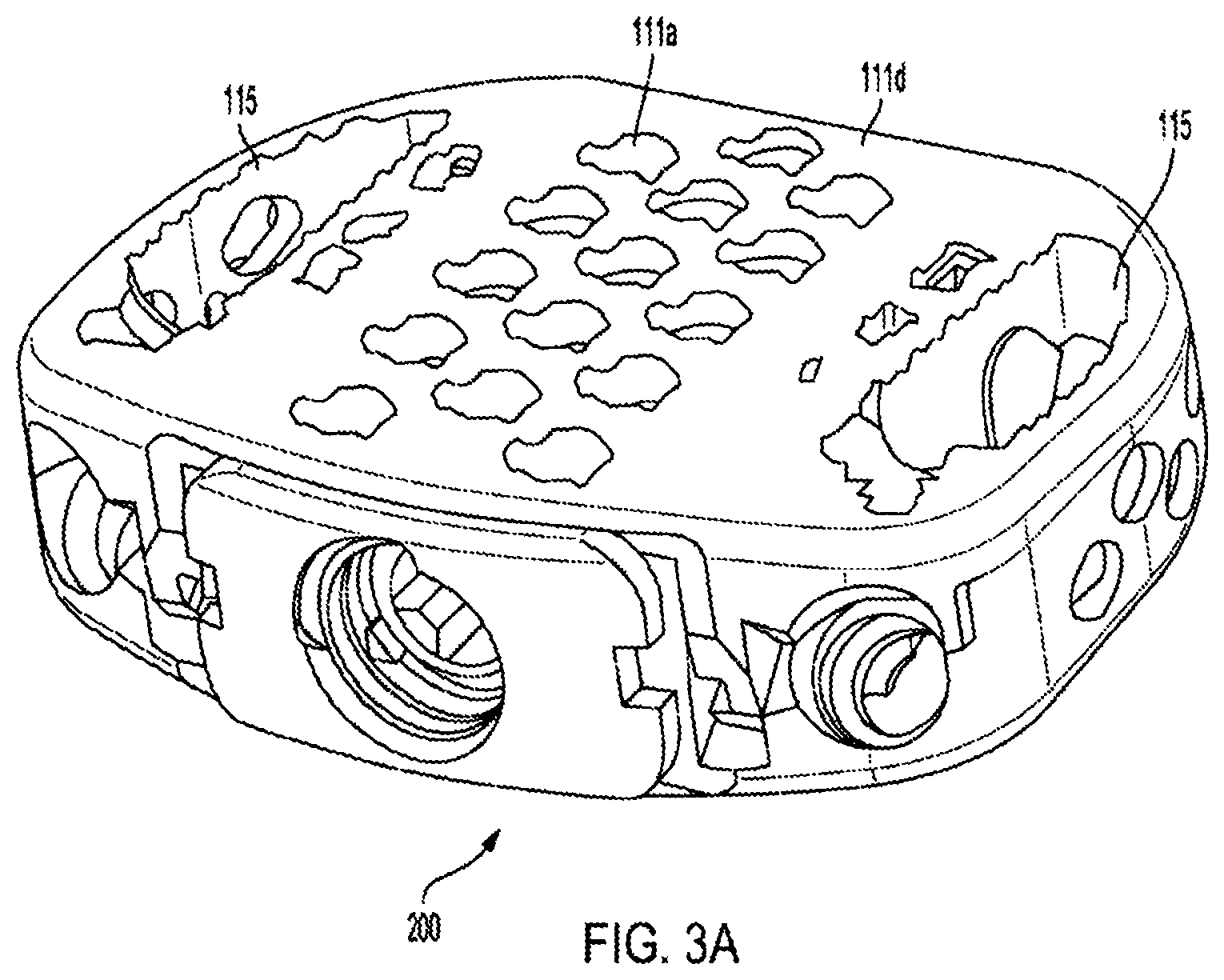 Patent US12318308 Figure 11 – Dual expandable inter-body device