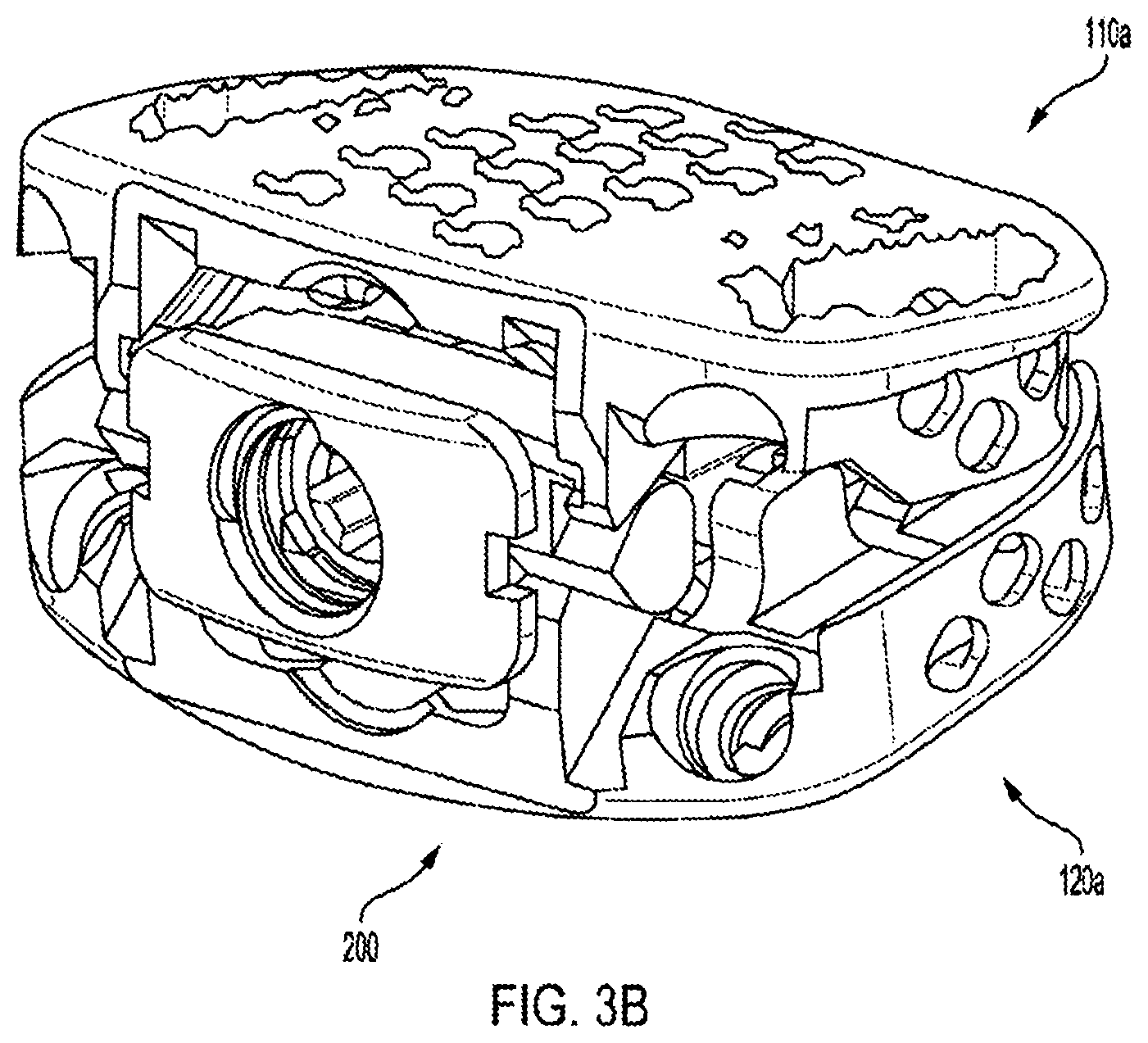 Patent US12318308 Figure 12 – Dual expandable inter-body device