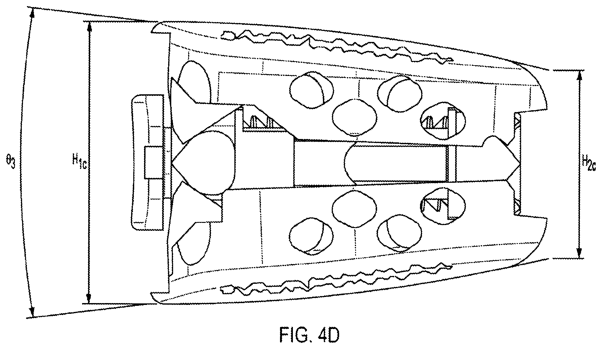 Patent US12318308 Figure 16 – Dual expandable inter-body device