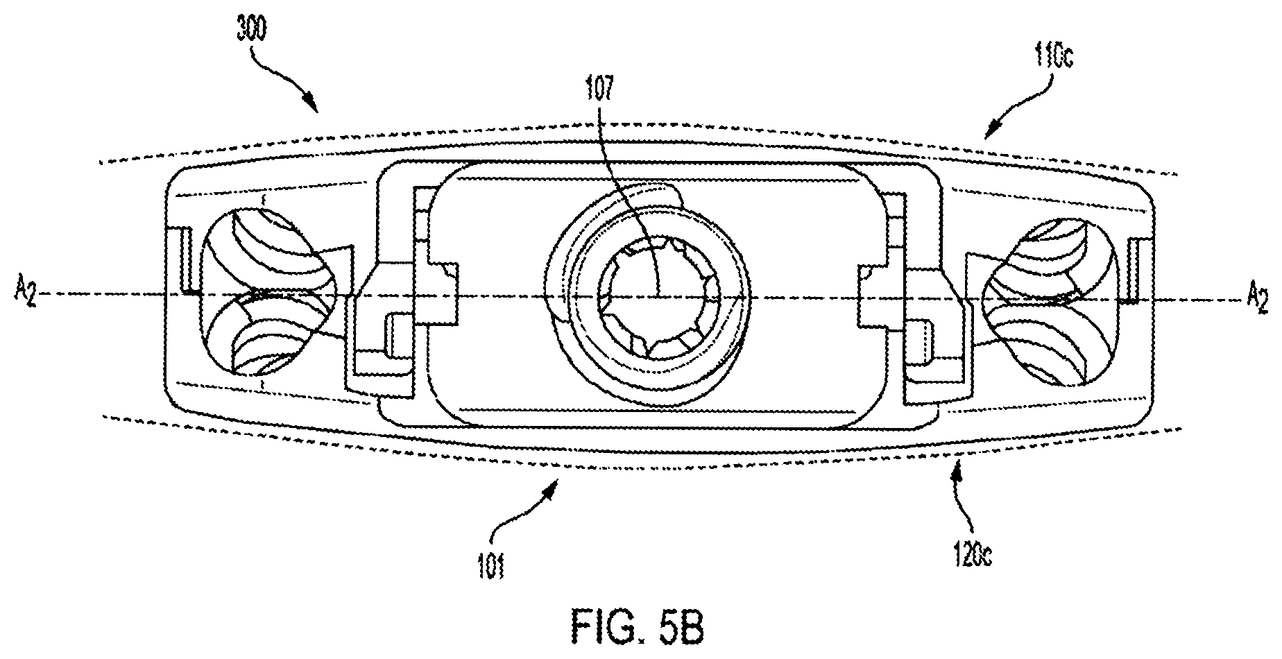 Patent US12318308 Figure 18 – Dual expandable inter-body device