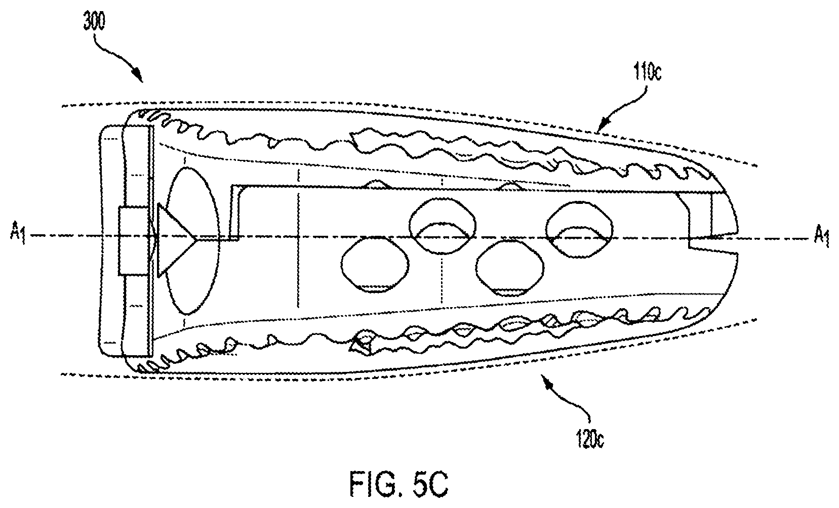 Patent US12318308 Figure 19 – Dual expandable inter-body device