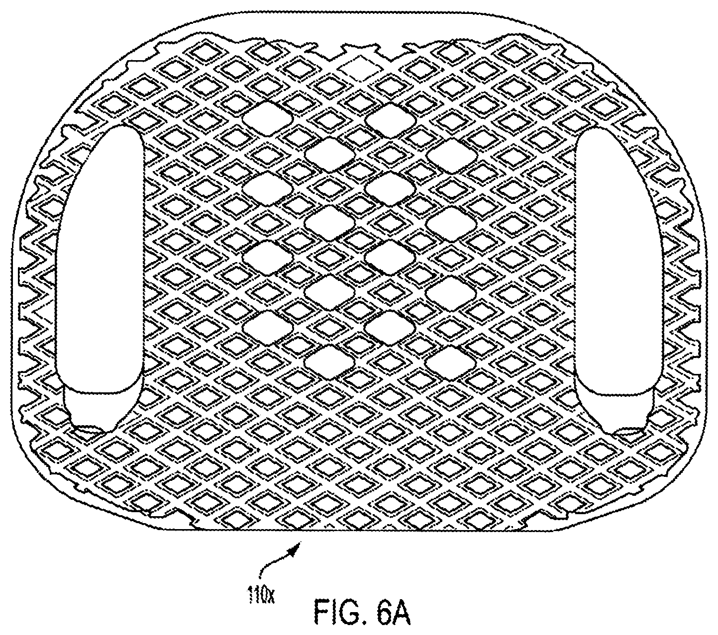 Patent US12318308 Figure 20 – Dual expandable inter-body device