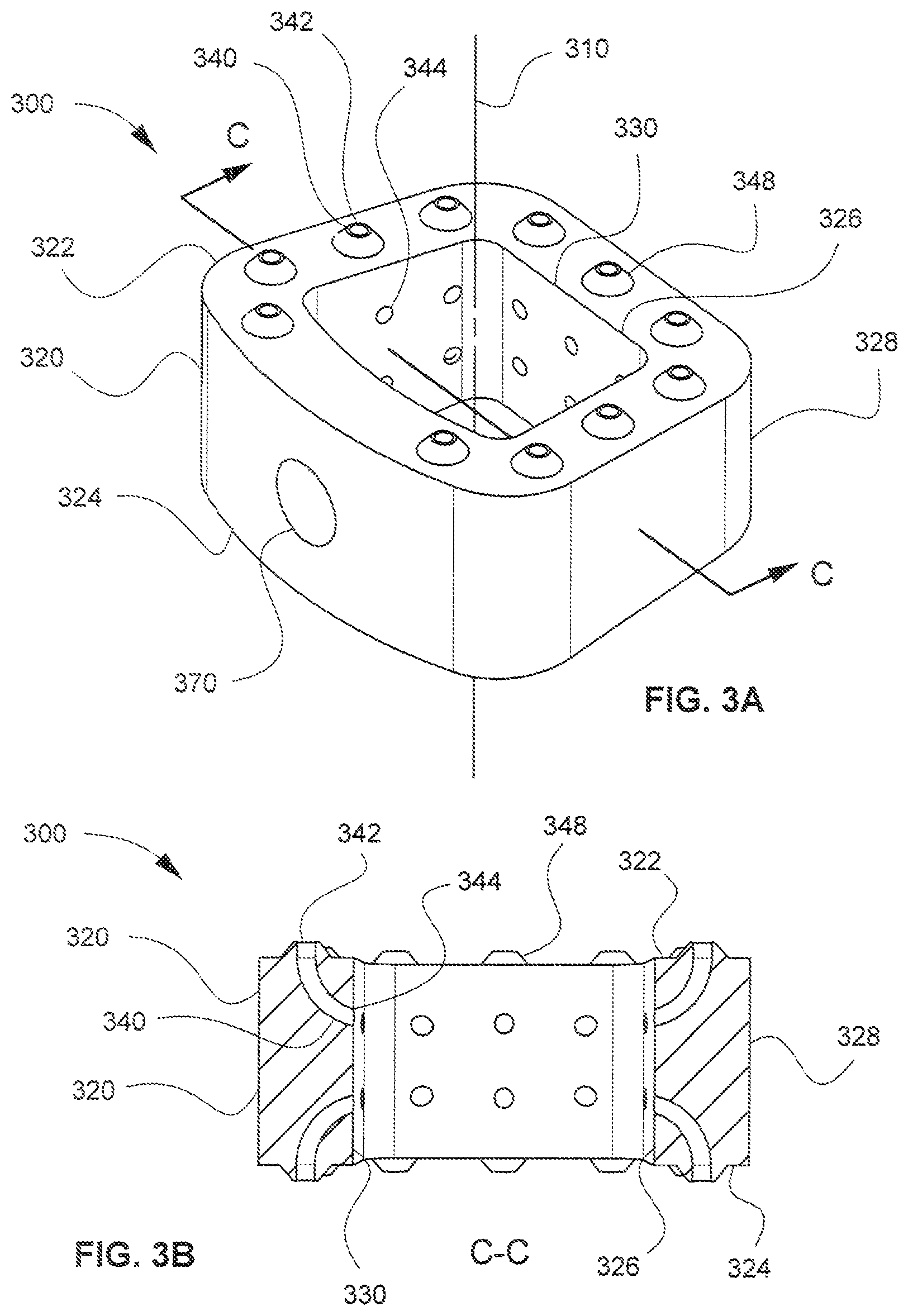 Patent US12318309 Figure 3 – Modular interbody spacer
