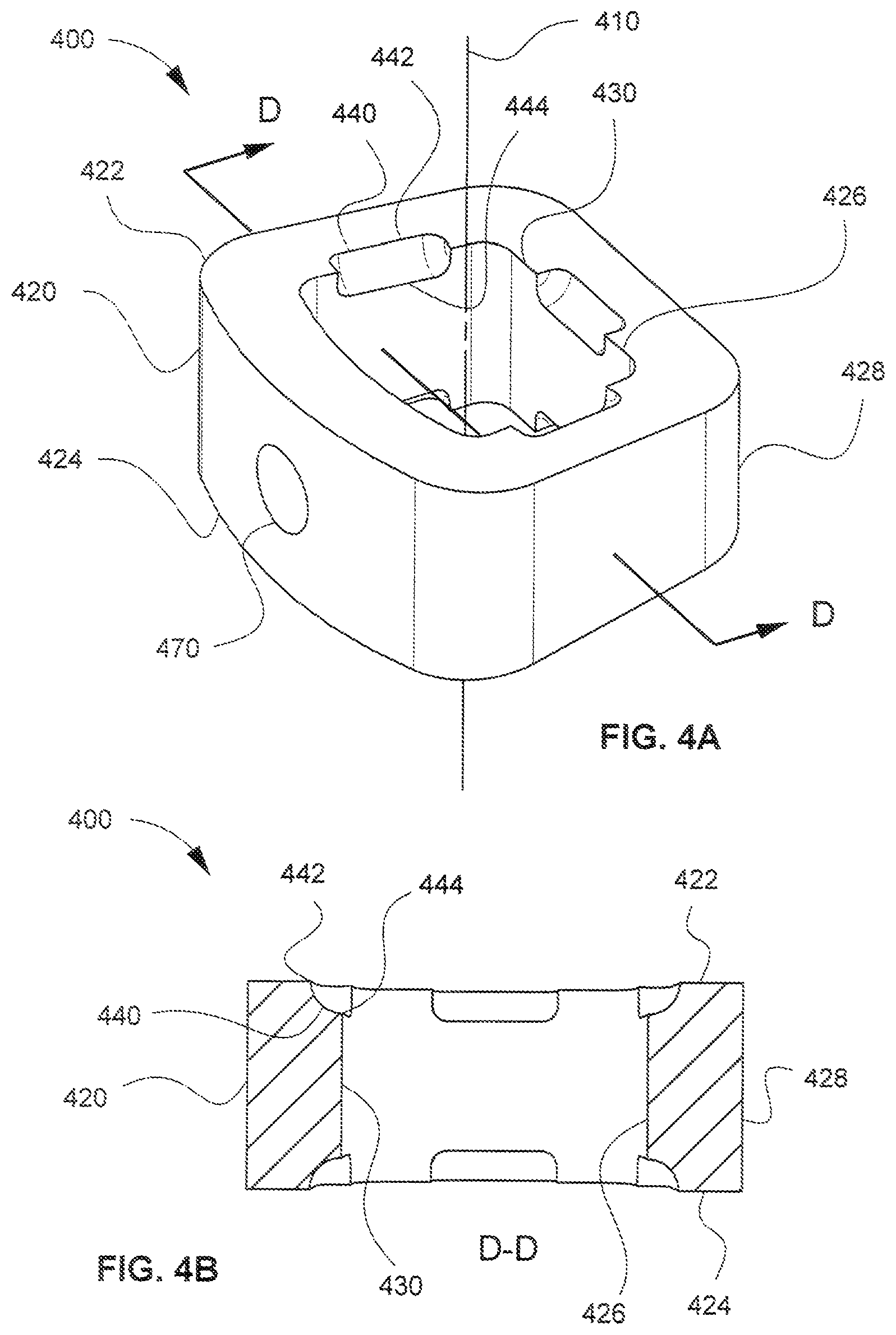 Patent US12318309 Figure 4 – Modular interbody spacer