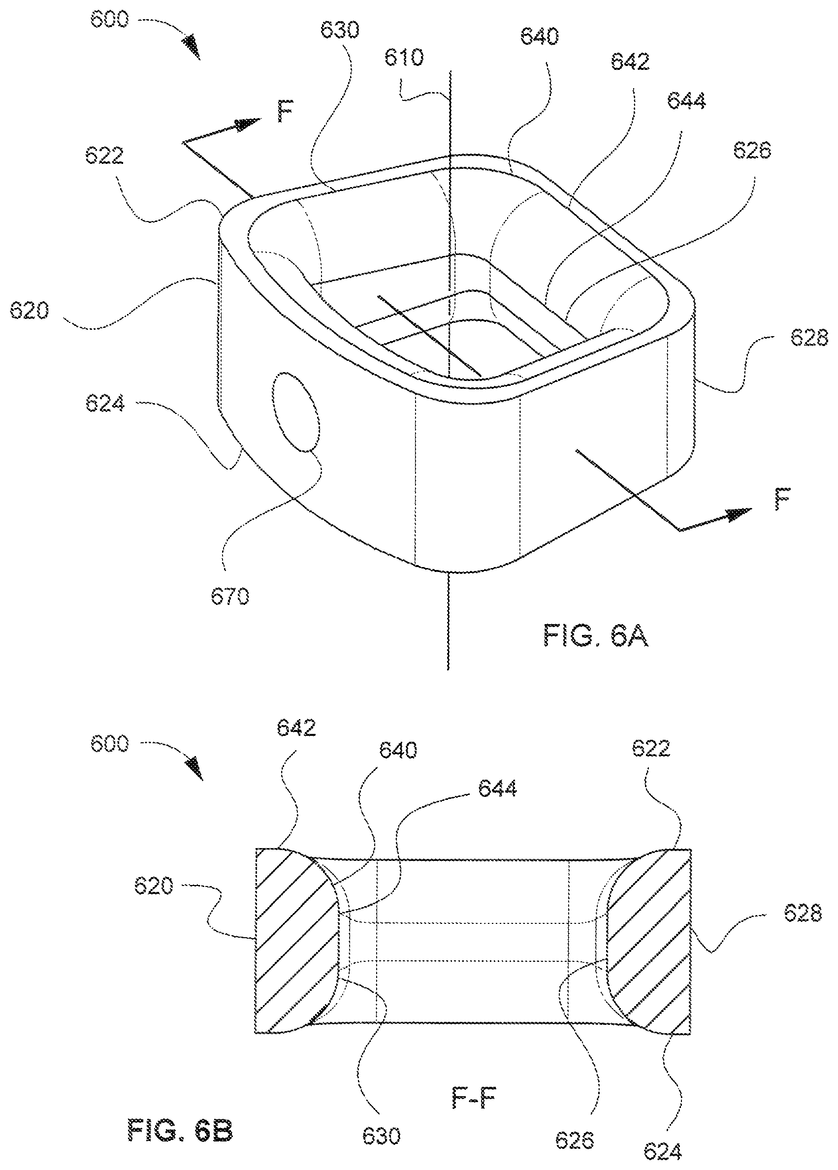 Patent US12318309 Figure 6 – Modular interbody spacer